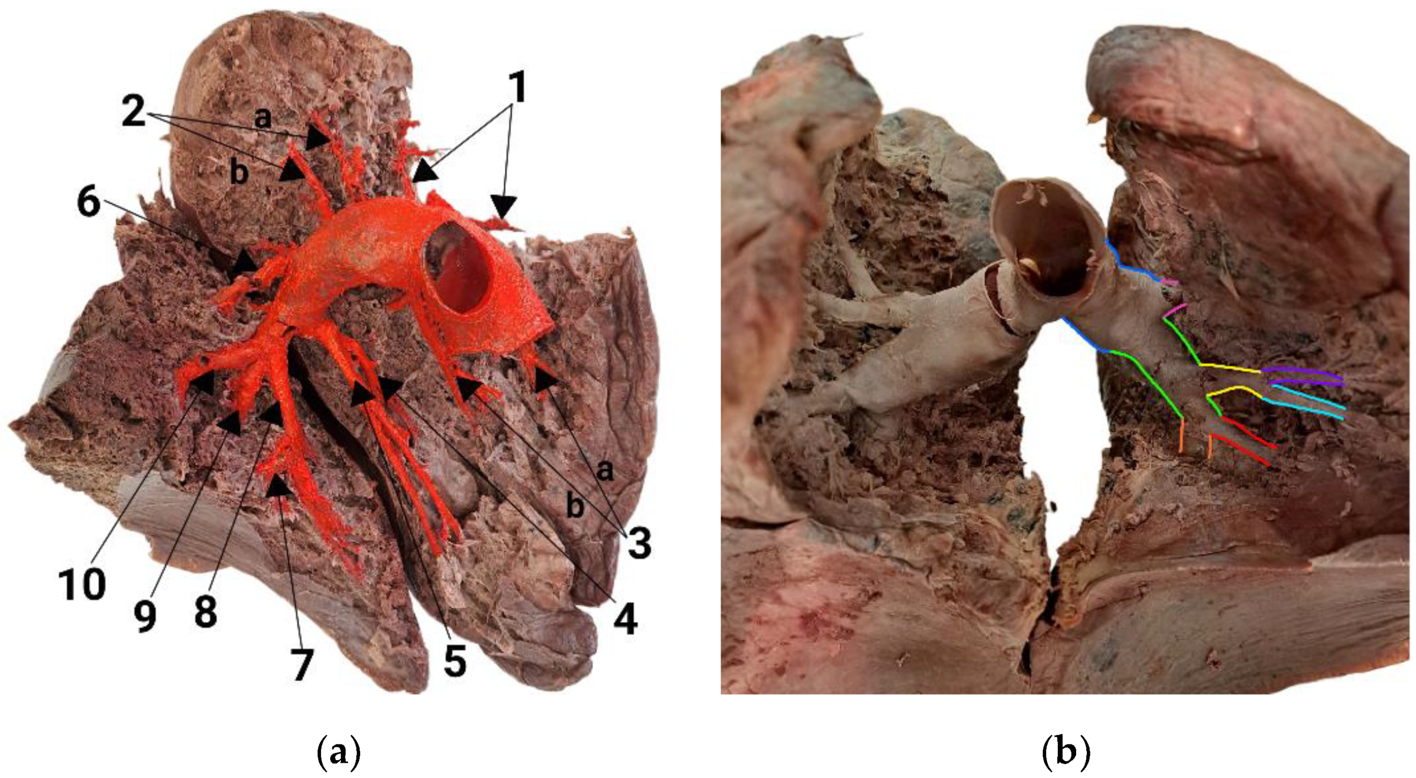 Diagnostics 14 01684 g003 Diagnostics 14 01684 g003