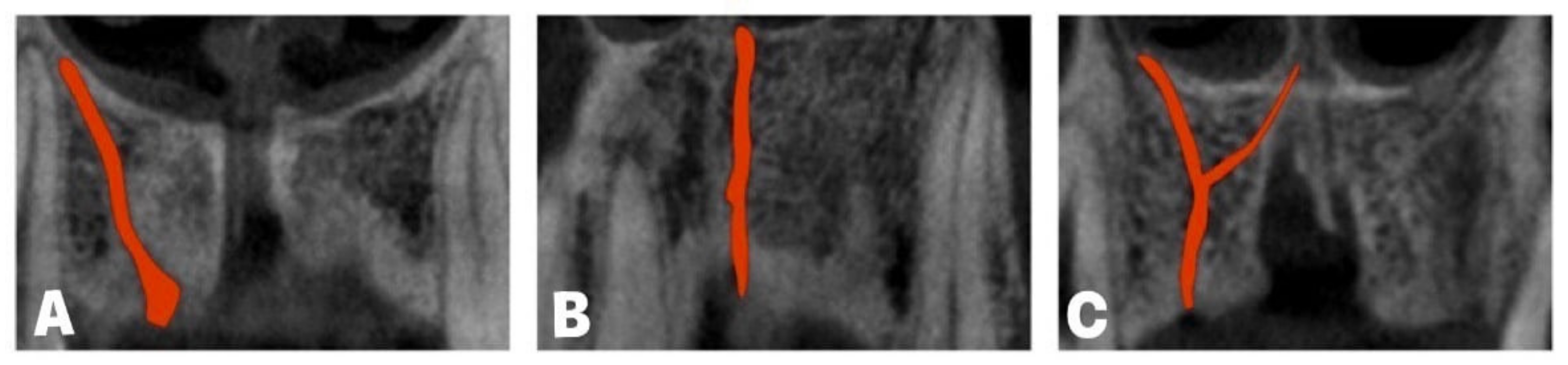 Diagnostics 14 01697 g004 Diagnostics 14 01697 g004