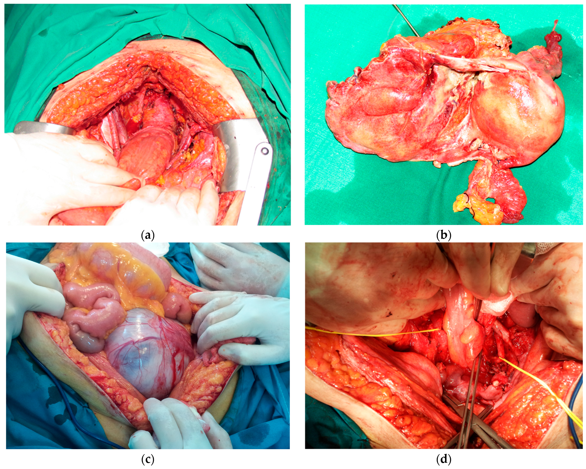 Diagnostics 14 01707 g001 Diagnostics 14 01707 g001