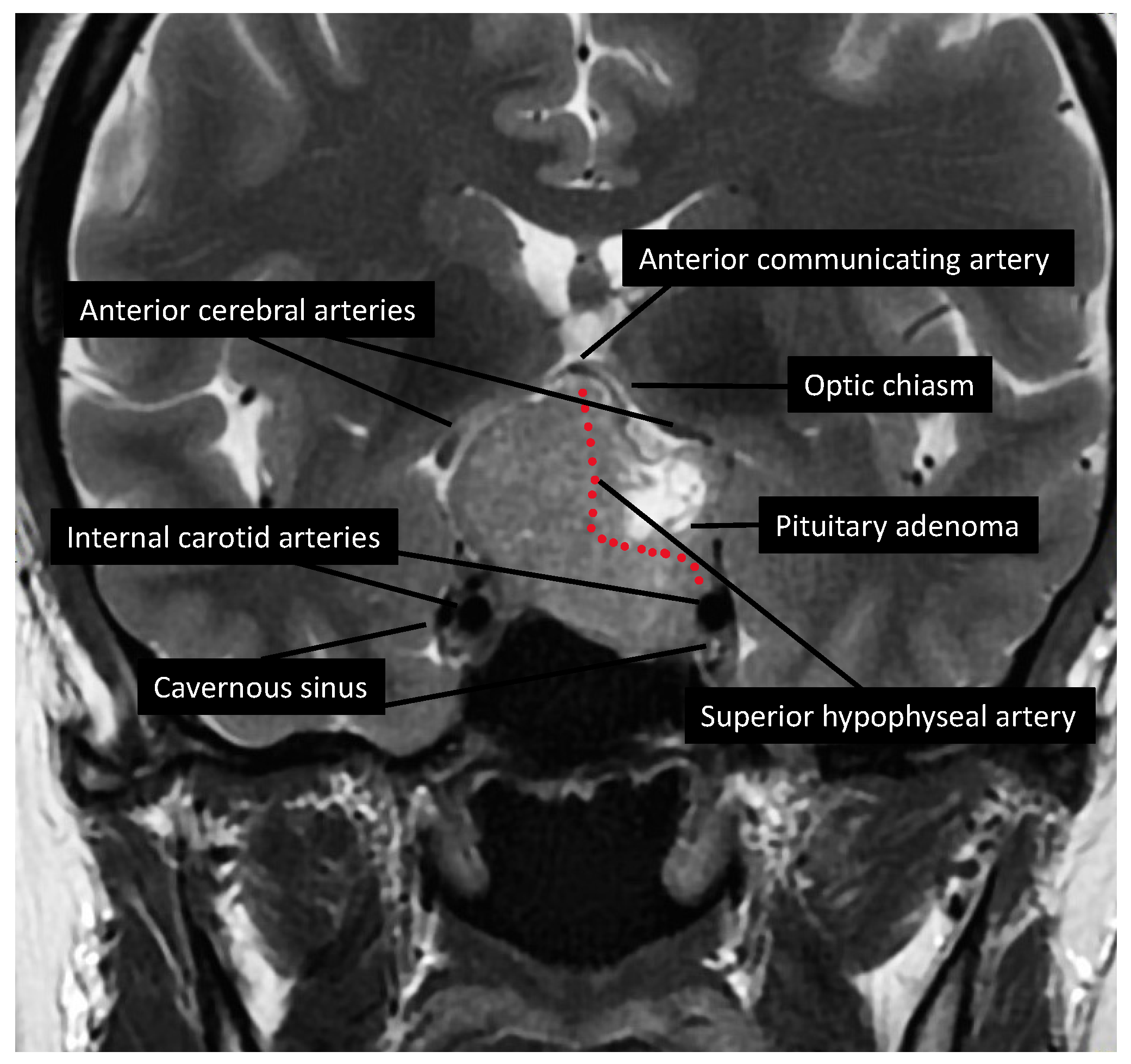 Diagnostics 14 01747 g0a1
