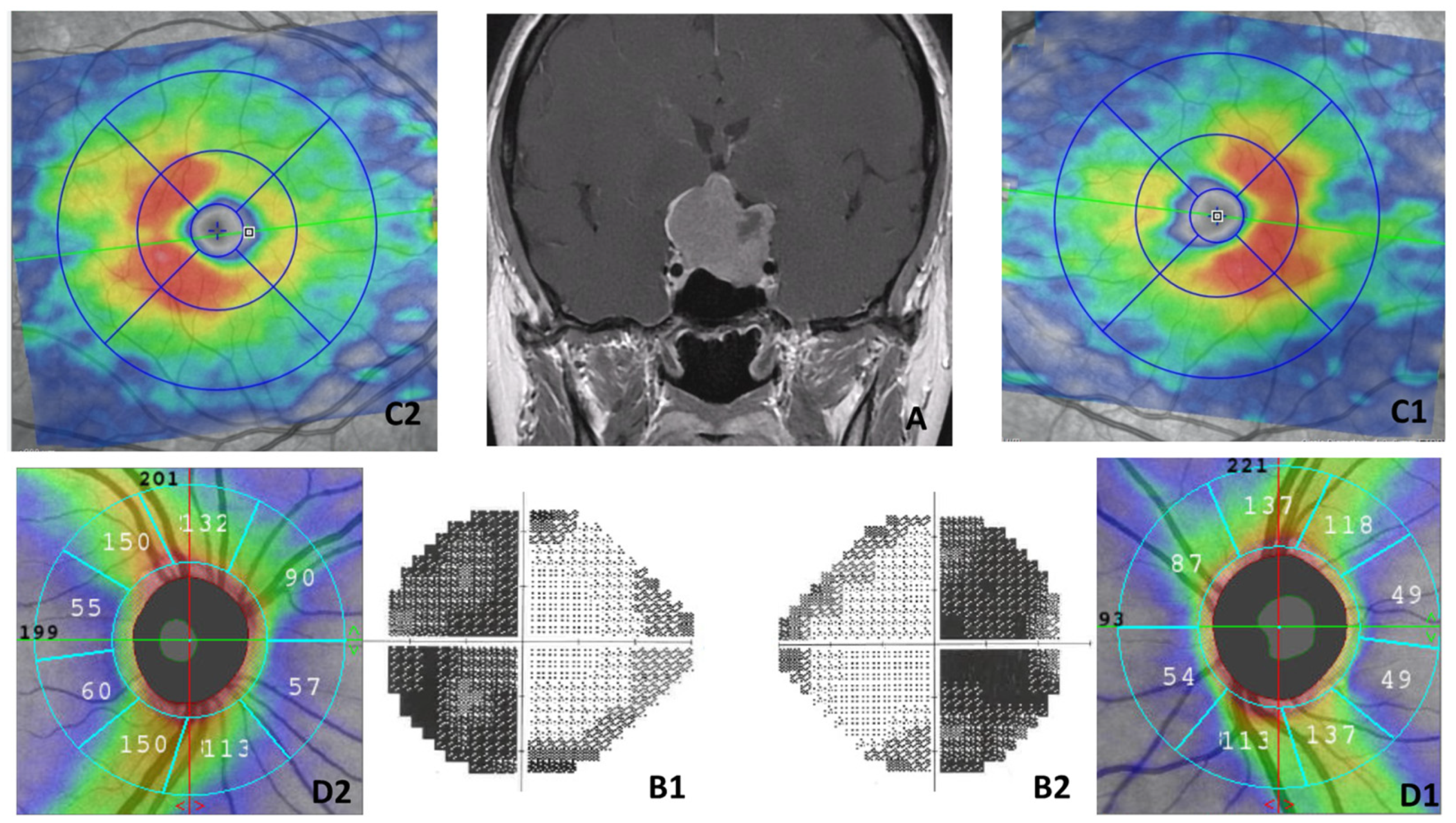 Diagnostics 14 01747 g0a3