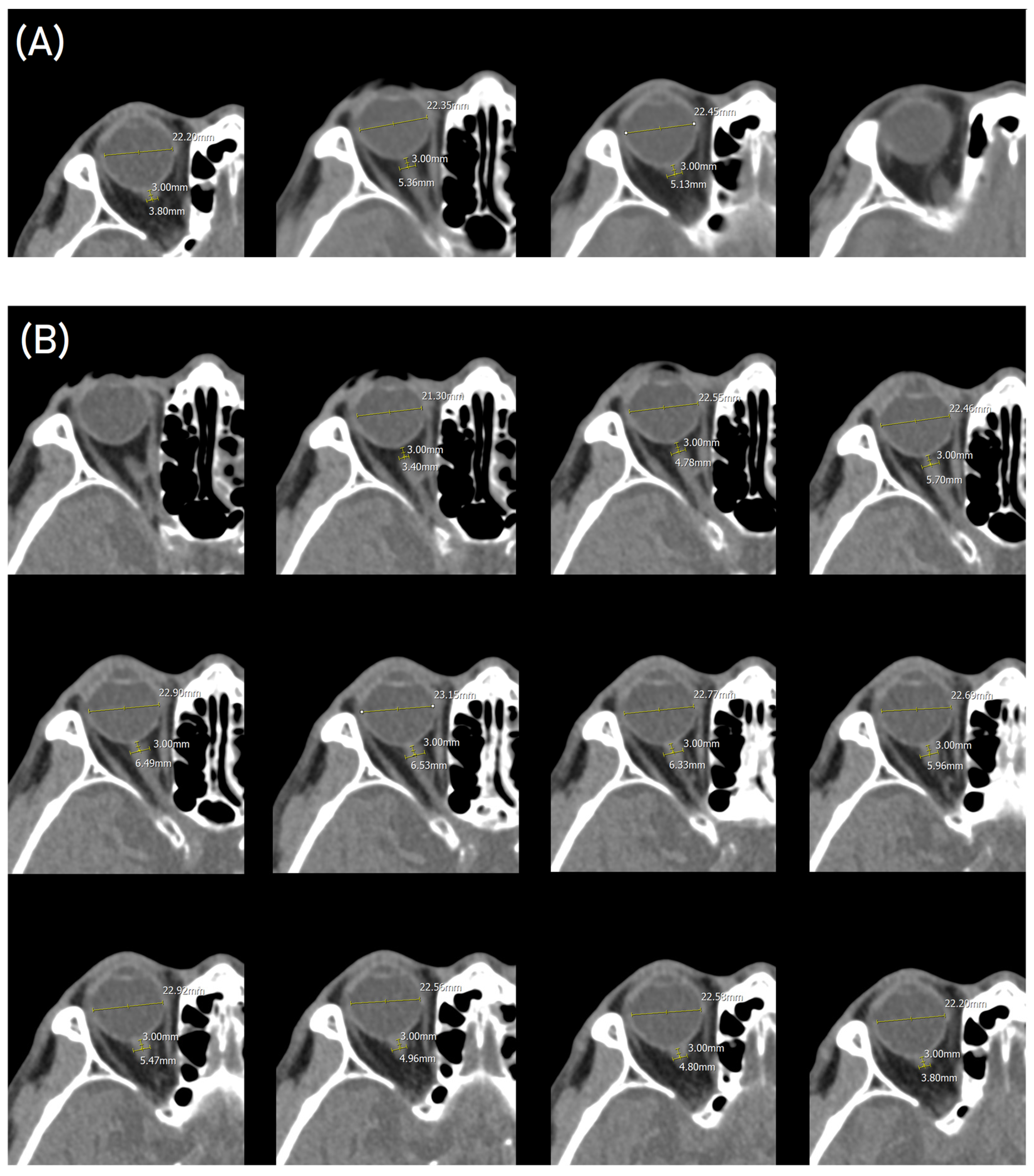 Diagnostics 14 01754 g001