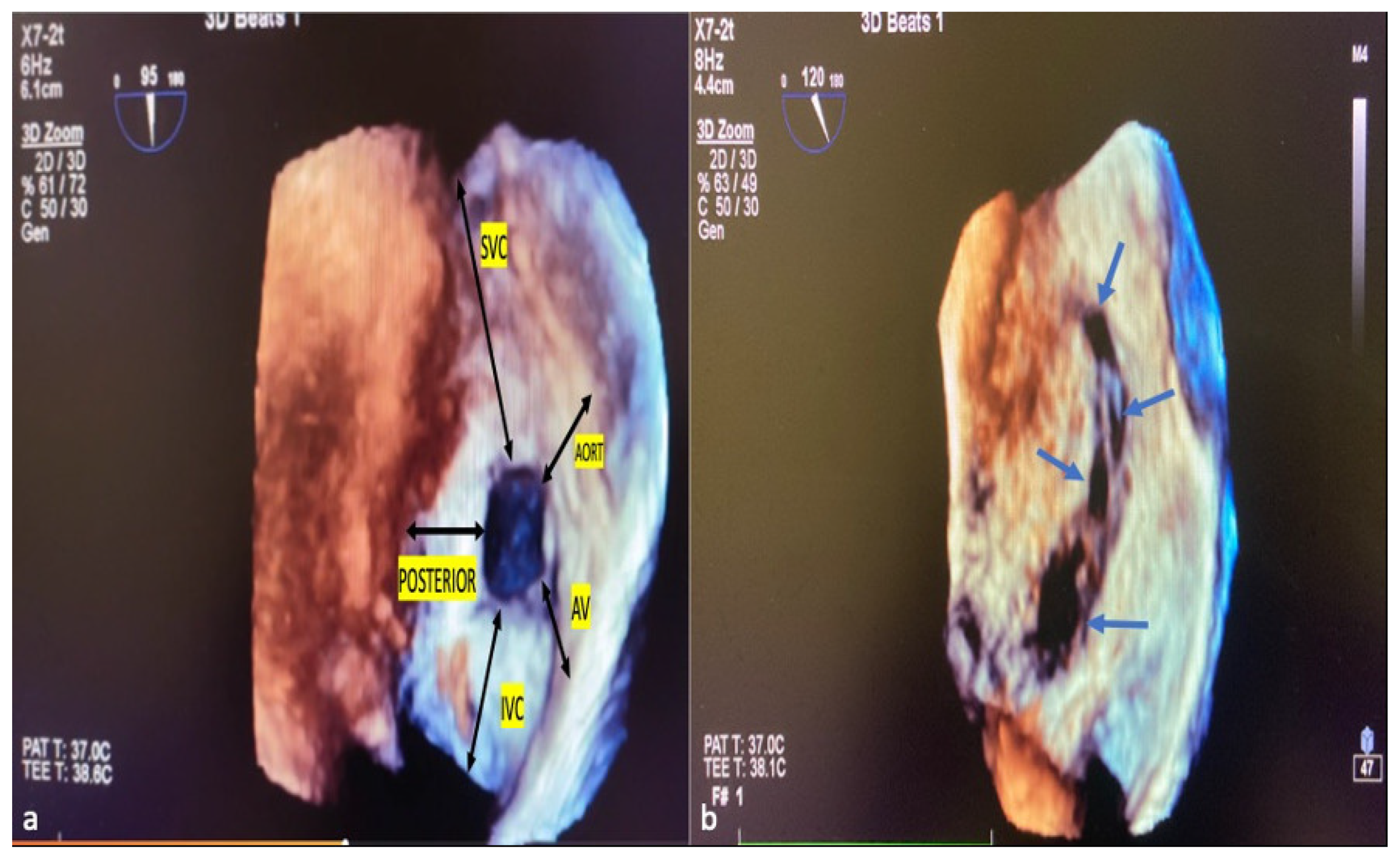 Diagnostics 14 01755 g004 Diagnostics 14 01755 g004