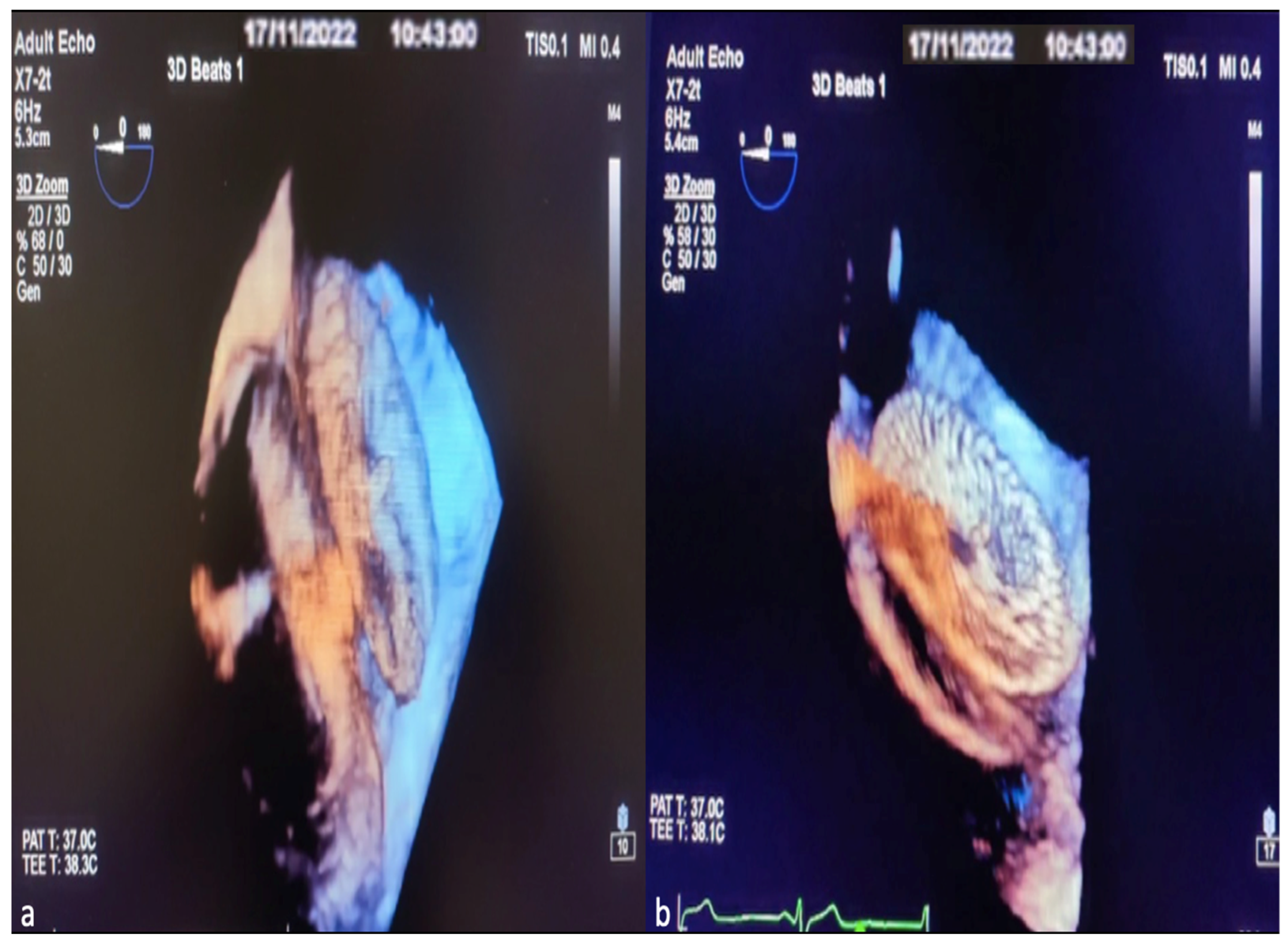 Diagnostics 14 01755 g005 Diagnostics 14 01755 g005