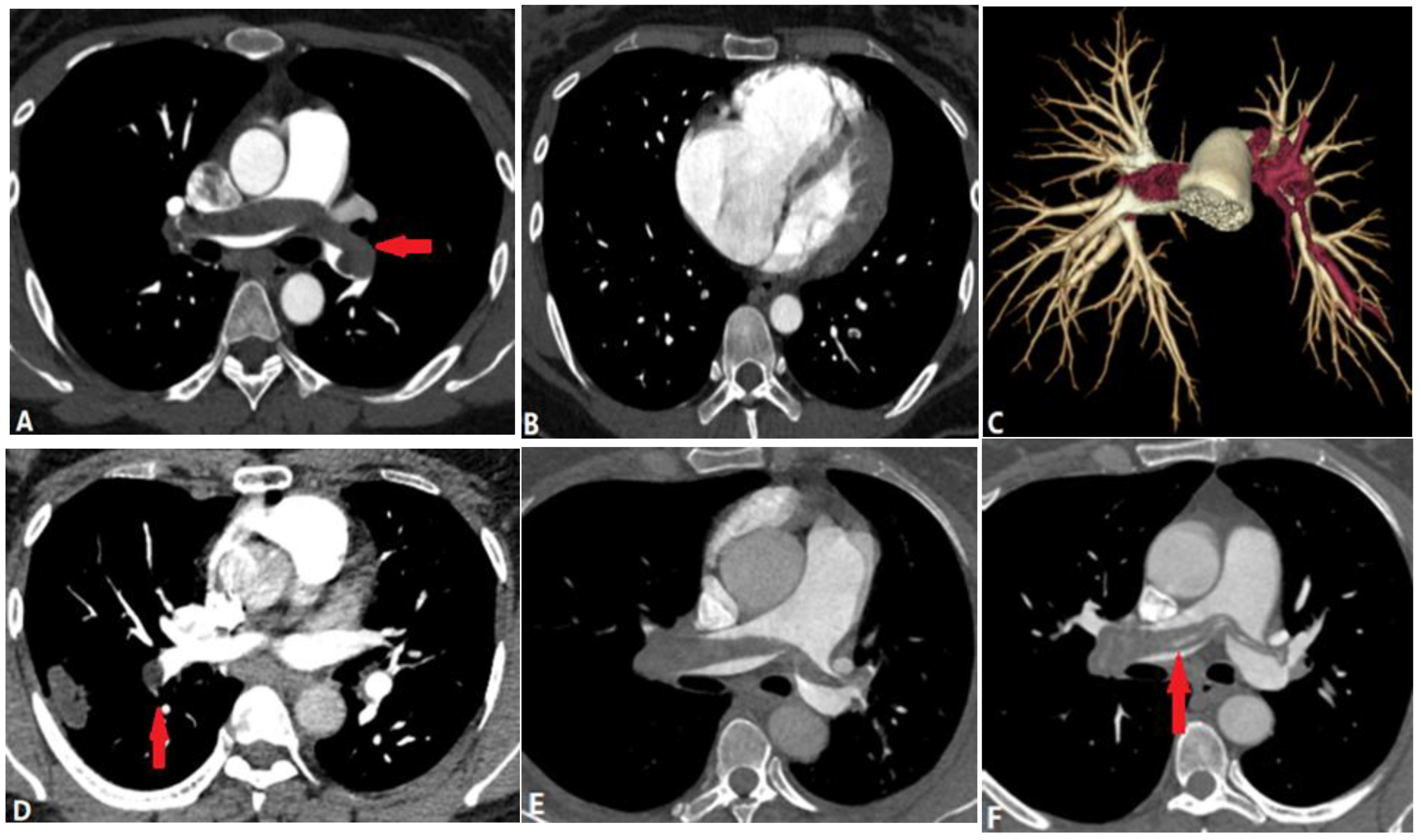 Diagnostics 14 01762 g004 Diagnostics 14 01762 g004