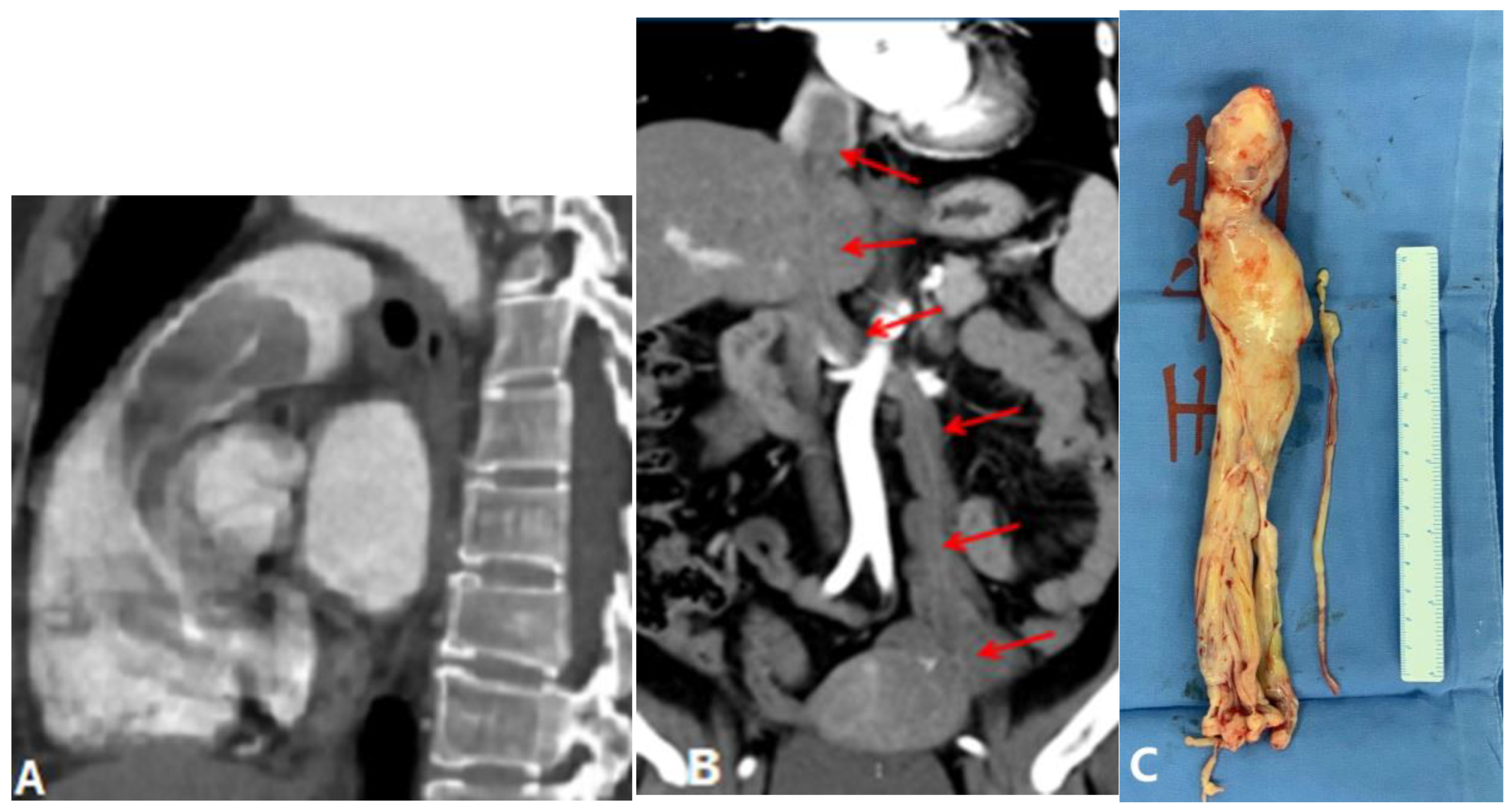Diagnostics 14 01762 g007 Diagnostics 14 01762 g007