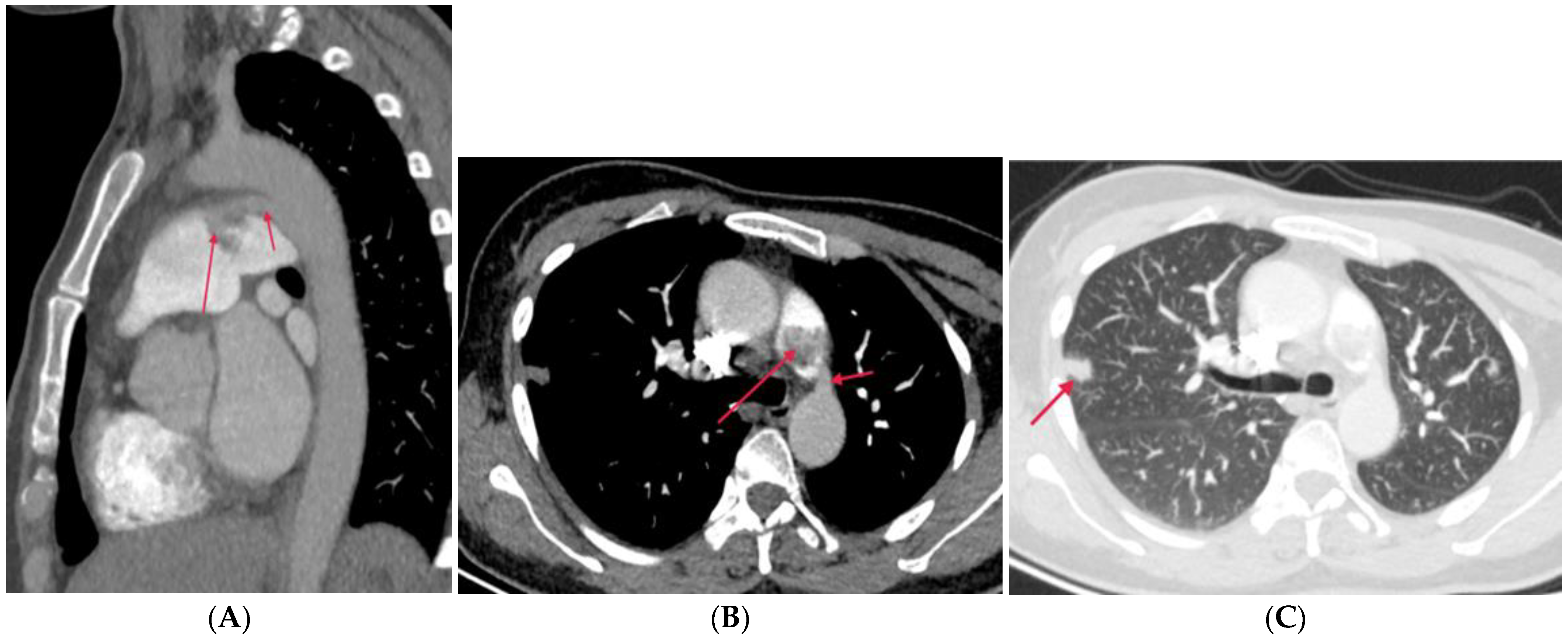 Diagnostics 14 01762 g009 Diagnostics 14 01762 g009