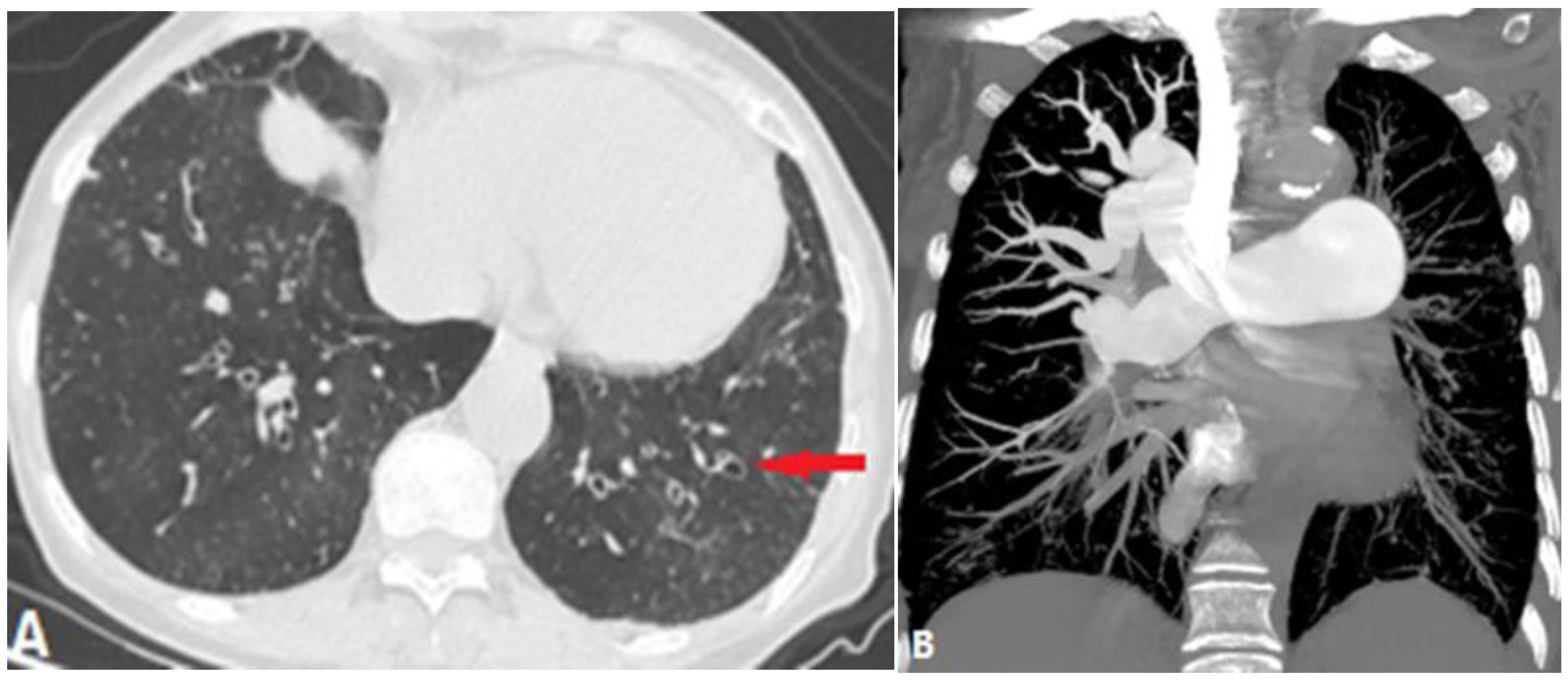 Diagnostics 14 01762 g015 Diagnostics 14 01762 g015