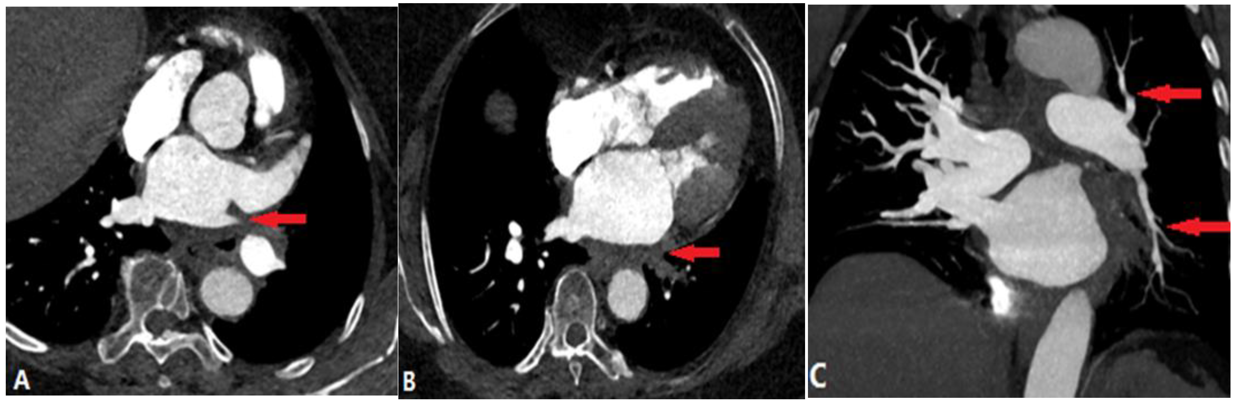 Diagnostics 14 01762 g021 Diagnostics 14 01762 g021