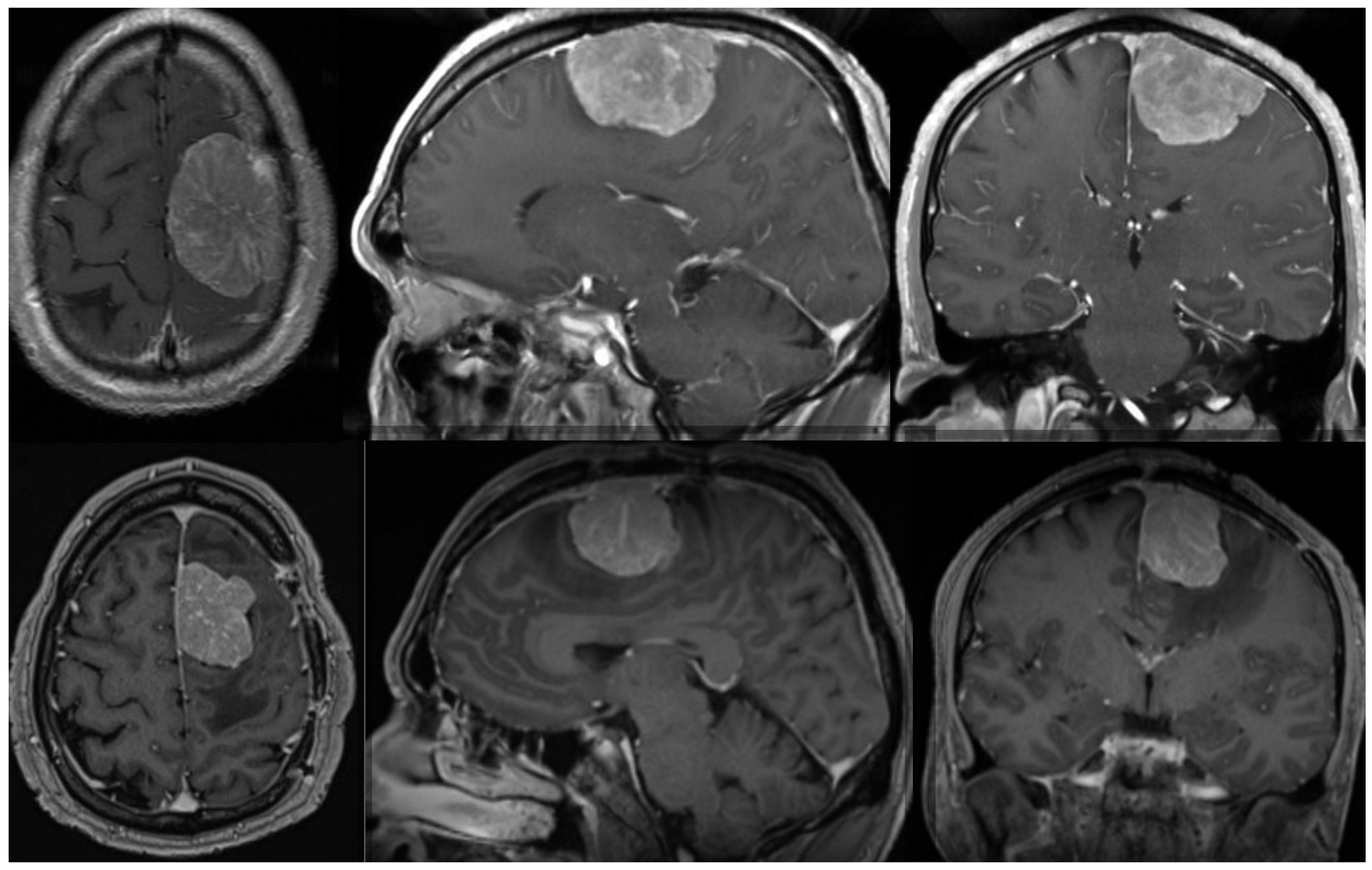 Diagnostics 14 01782 g001