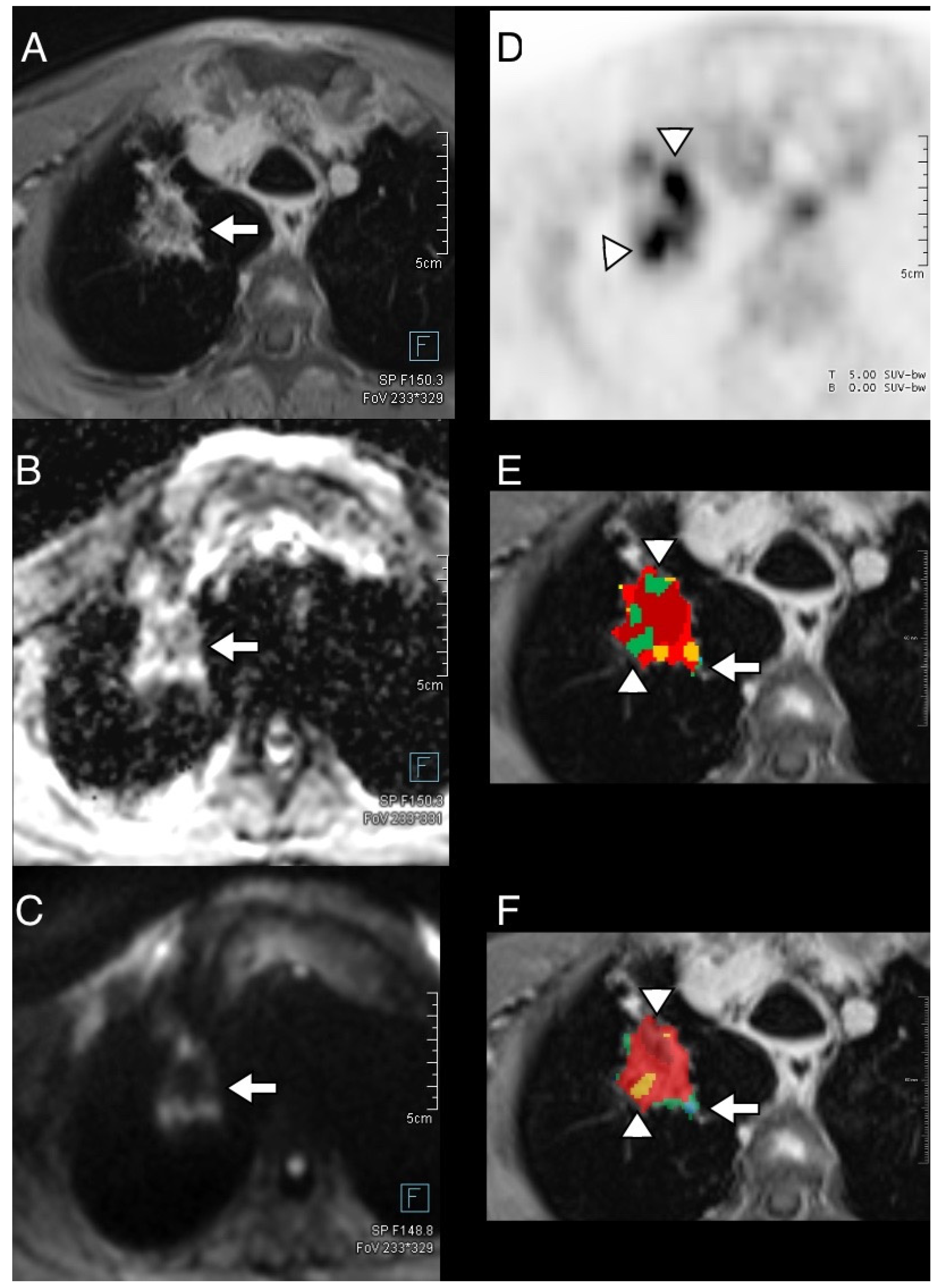 Diagnostics 14 01787 g005