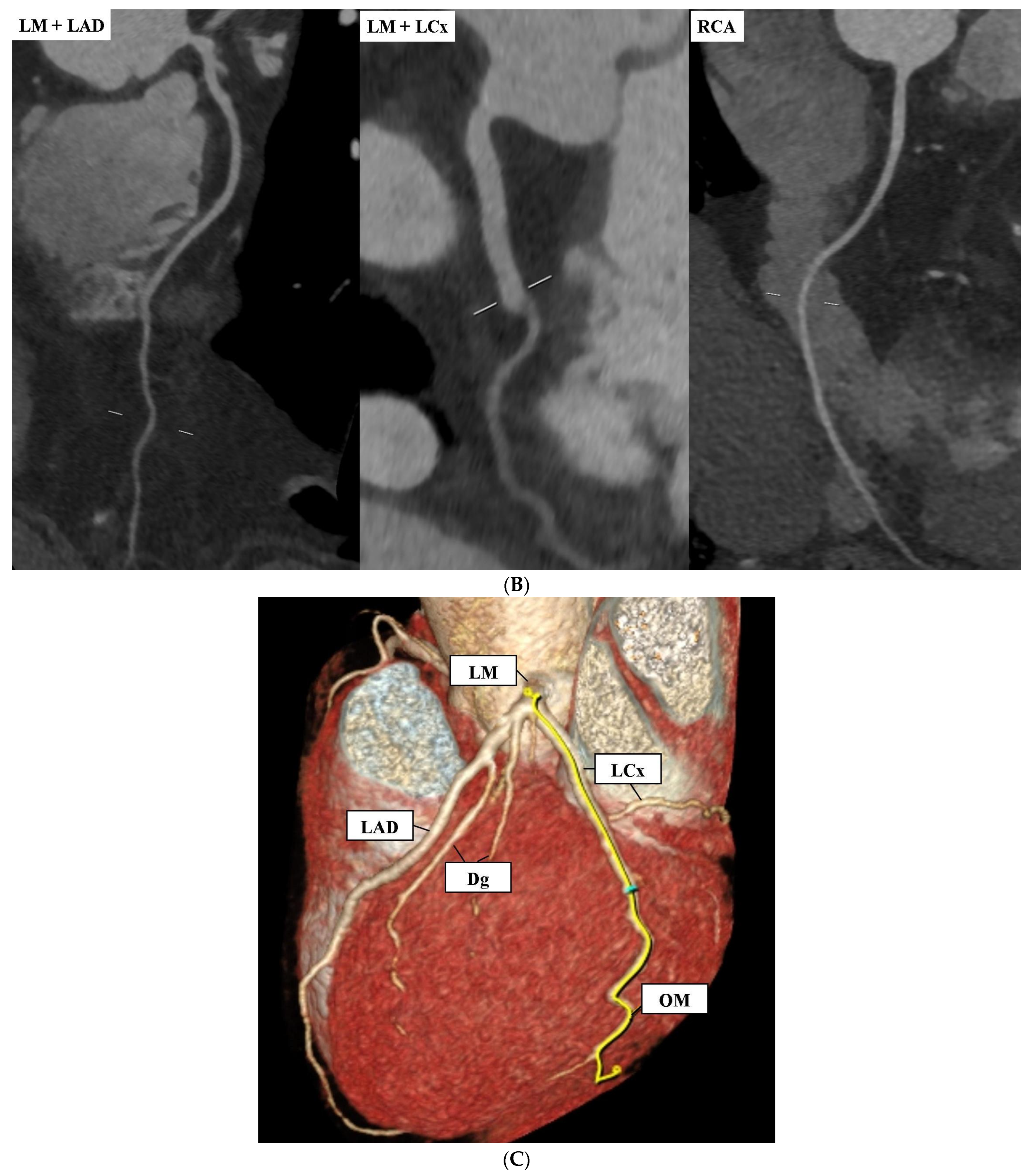 Diagnostics 14 01798 g001b