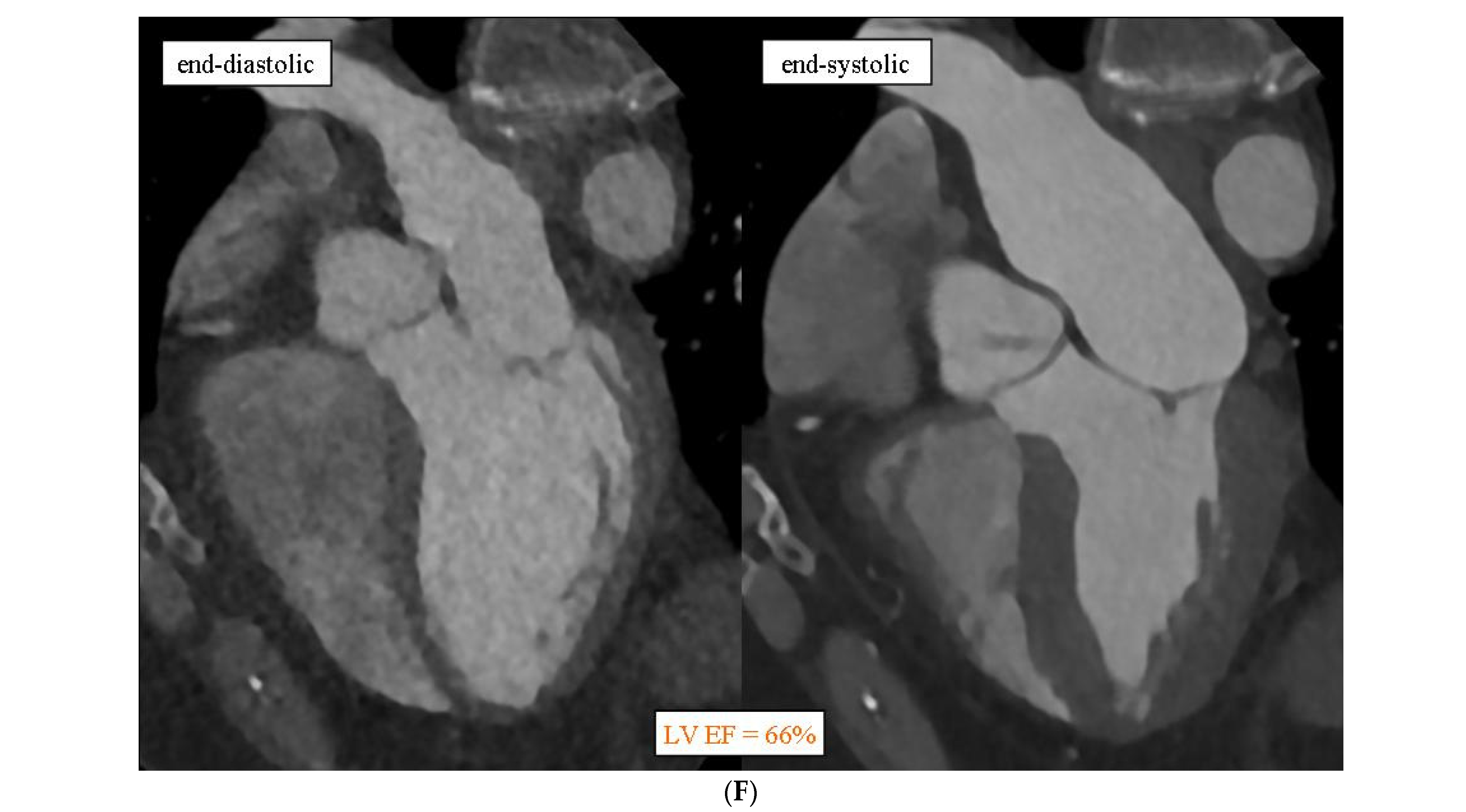 Diagnostics 14 01798 g001e