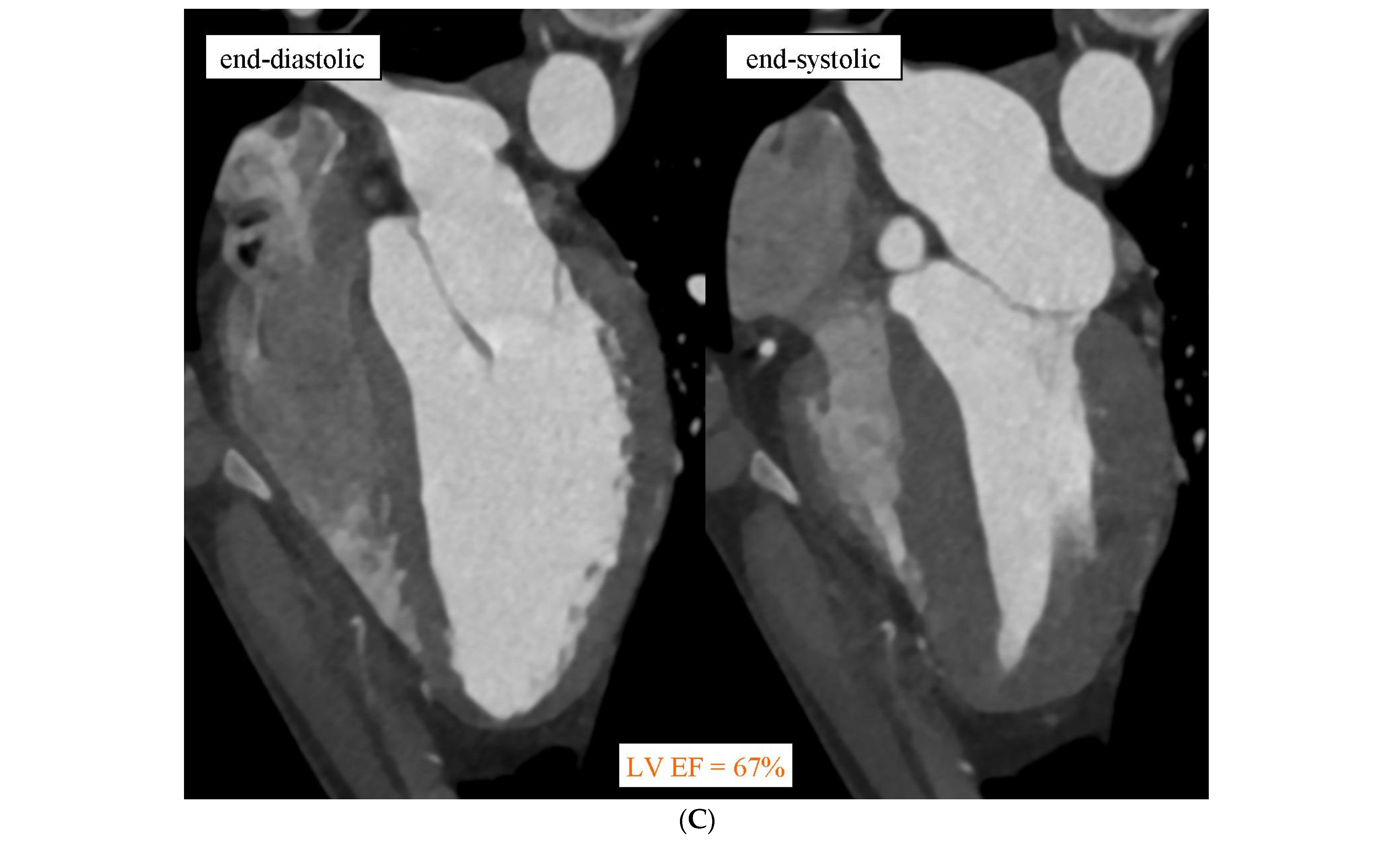 Diagnostics 14 01798 g002c