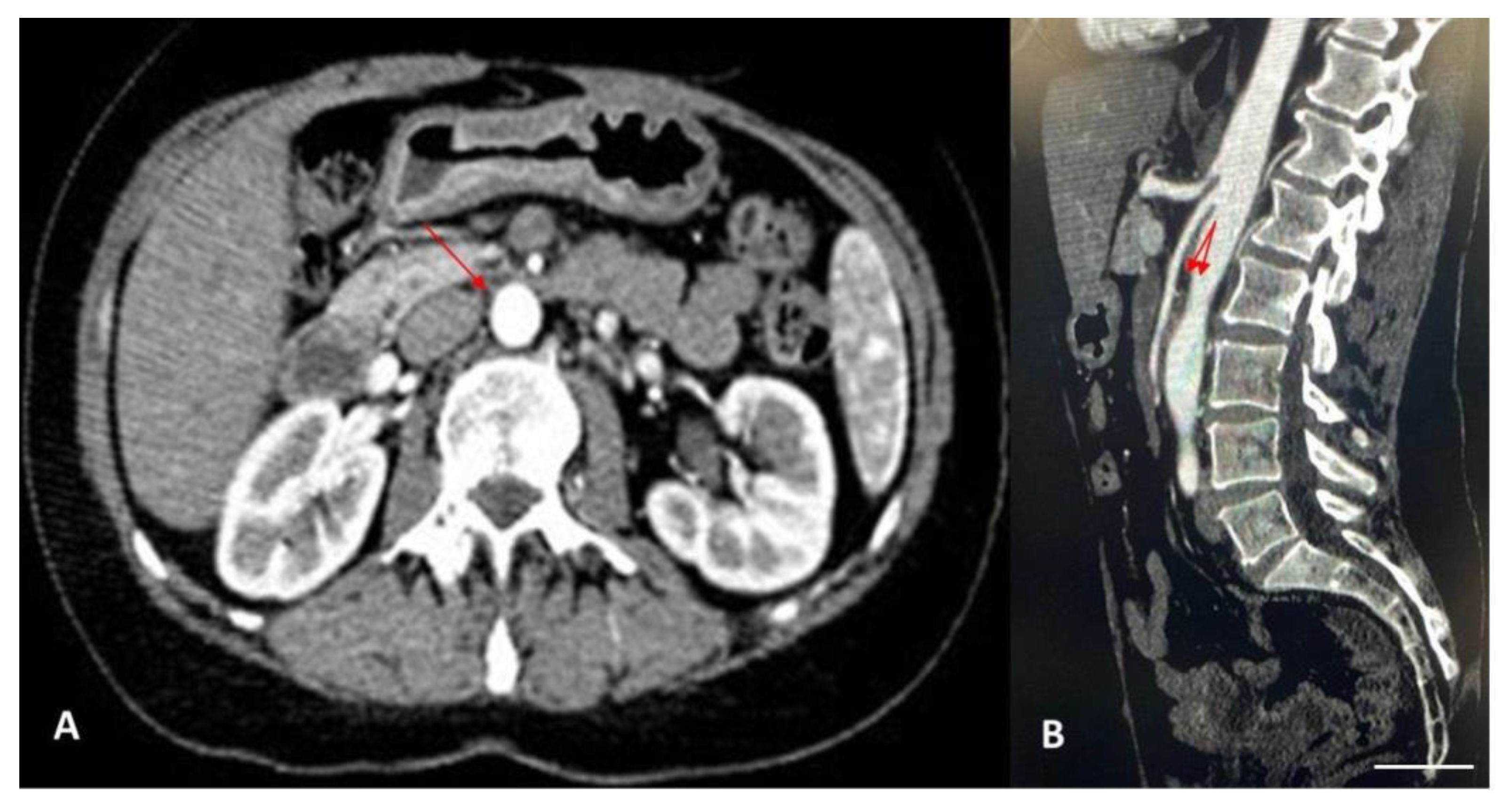 Diagnostics 14 01844 g002 Diagnostics 14 01844 g002