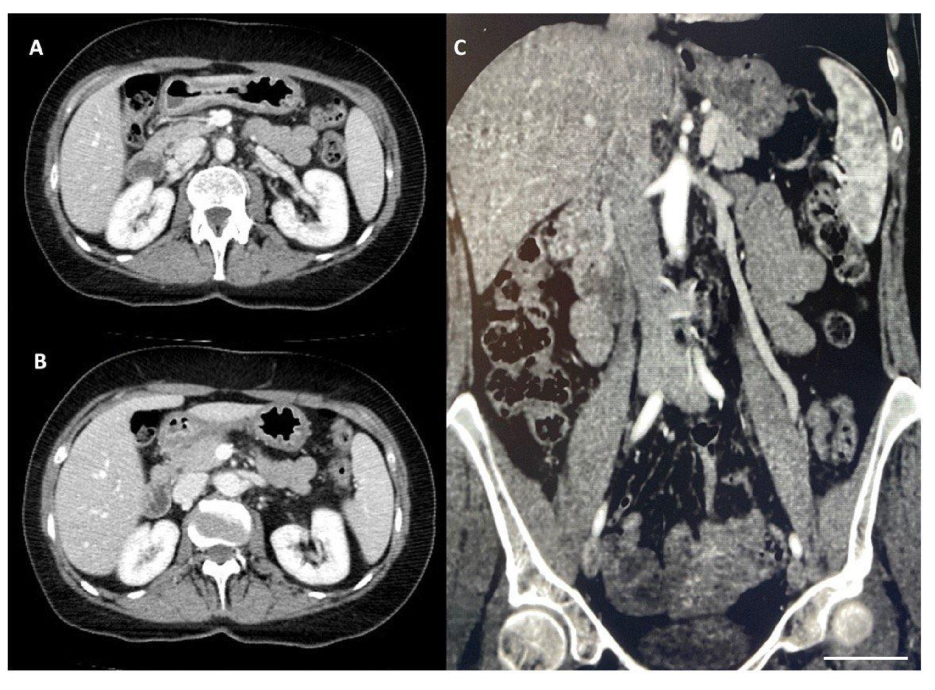 Diagnostics 14 01844 g003 Diagnostics 14 01844 g003