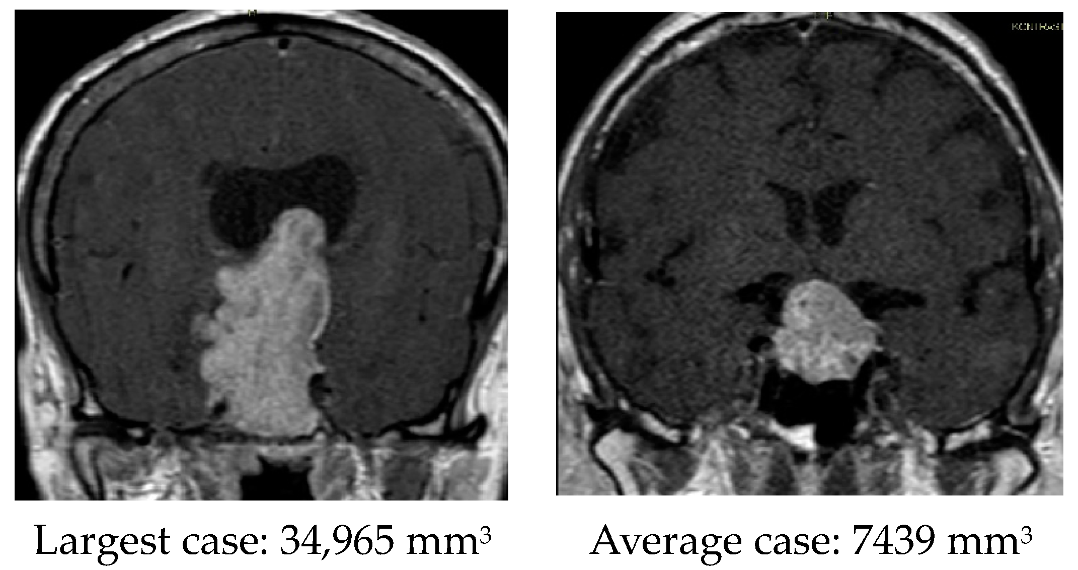Diagnostics 14 01863 g004
