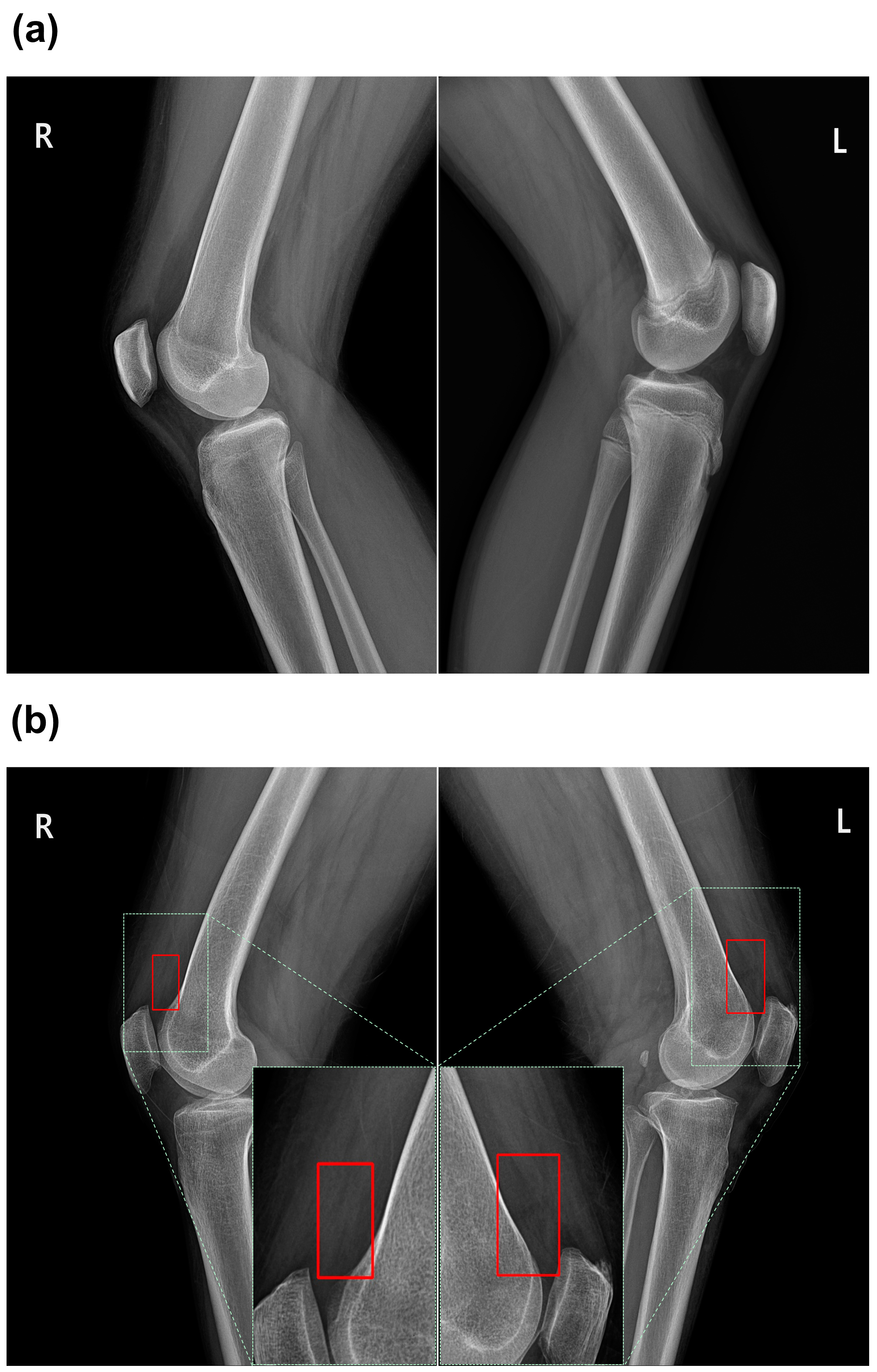 Diagnostics 14 01900 g002