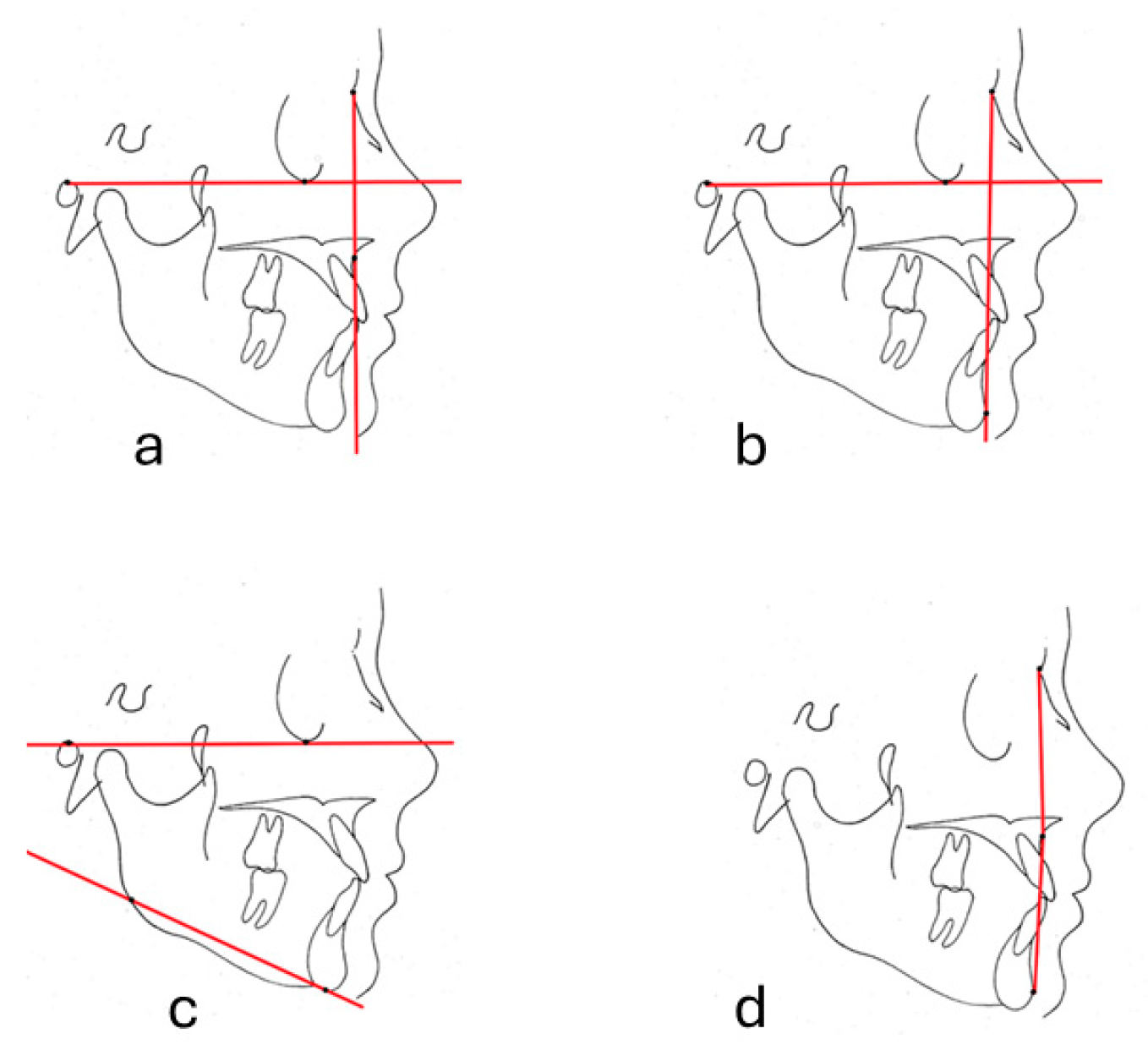 Diagnostics 14 01916 g002 Diagnostics 14 01916 g002