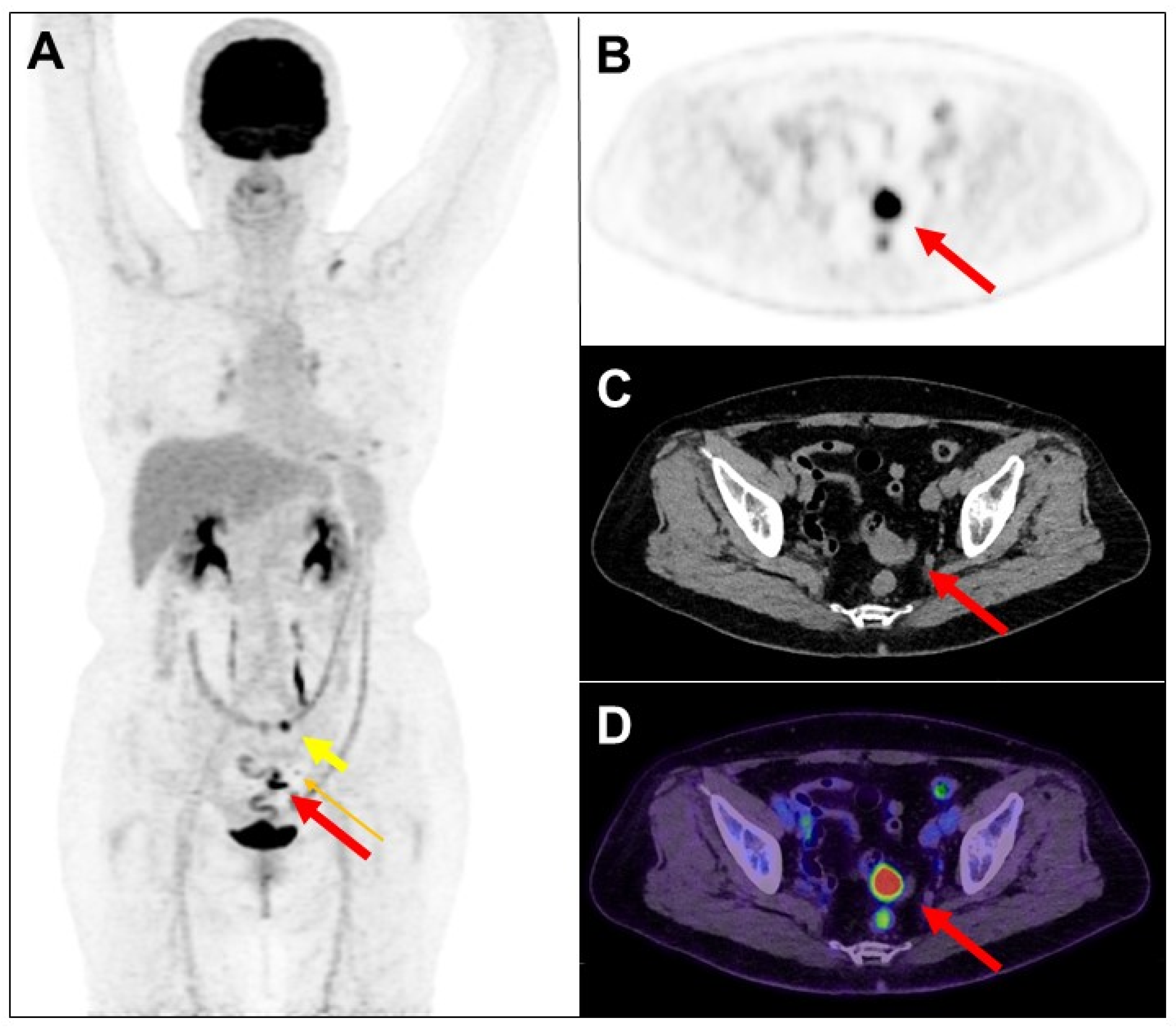 Diagnostics 14 01936 g001 Diagnostics 14 01936 g001