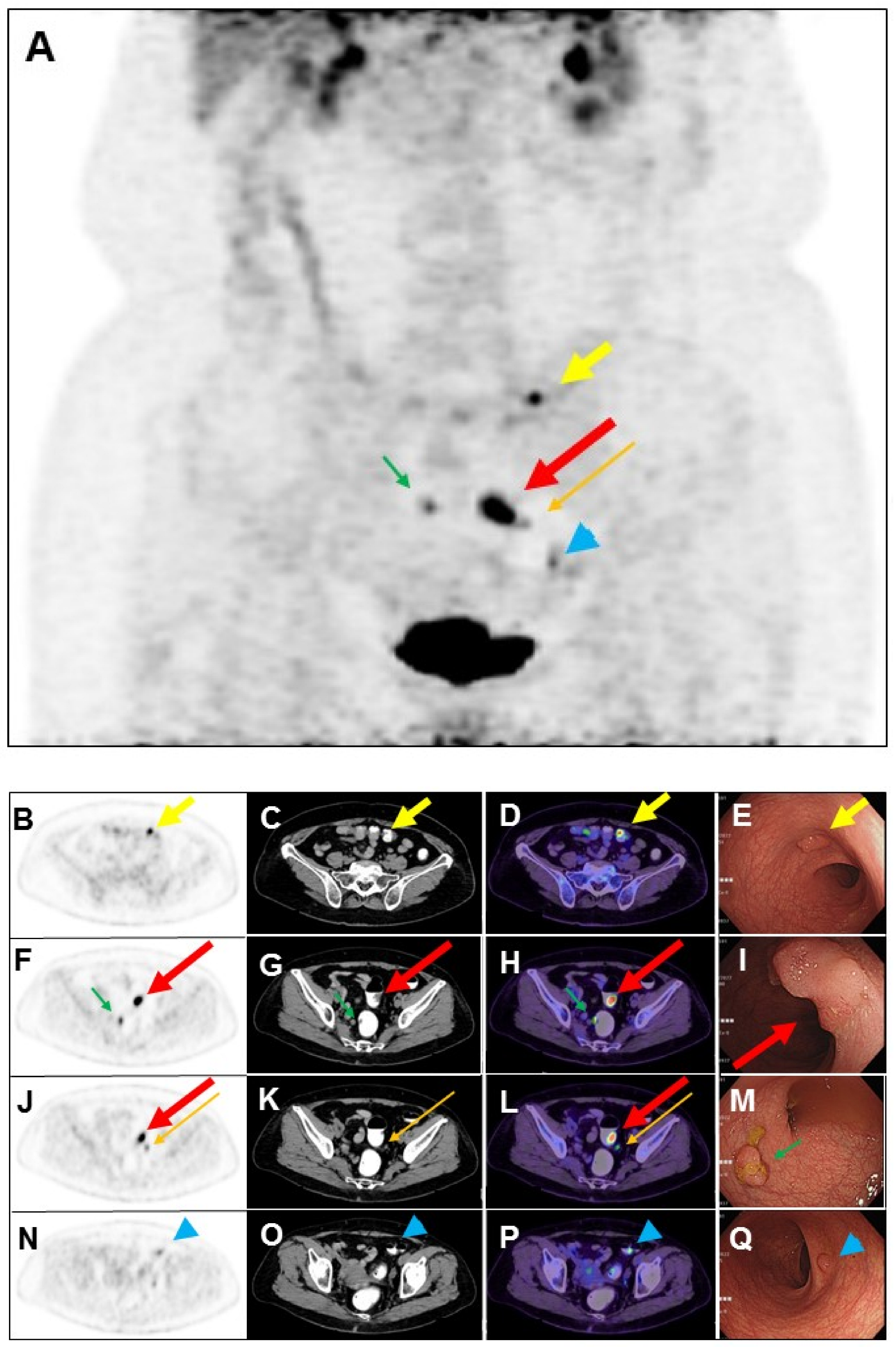 Diagnostics 14 01936 g002 Diagnostics 14 01936 g002