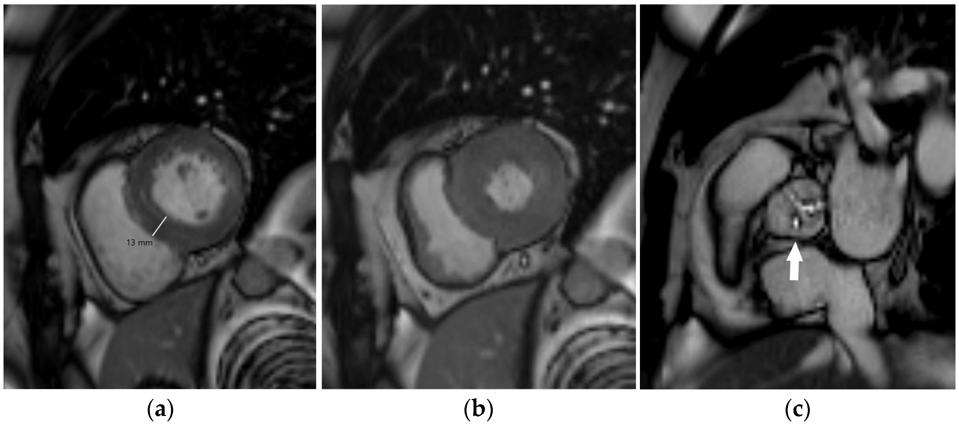 Diagnostics 14 01947 g002