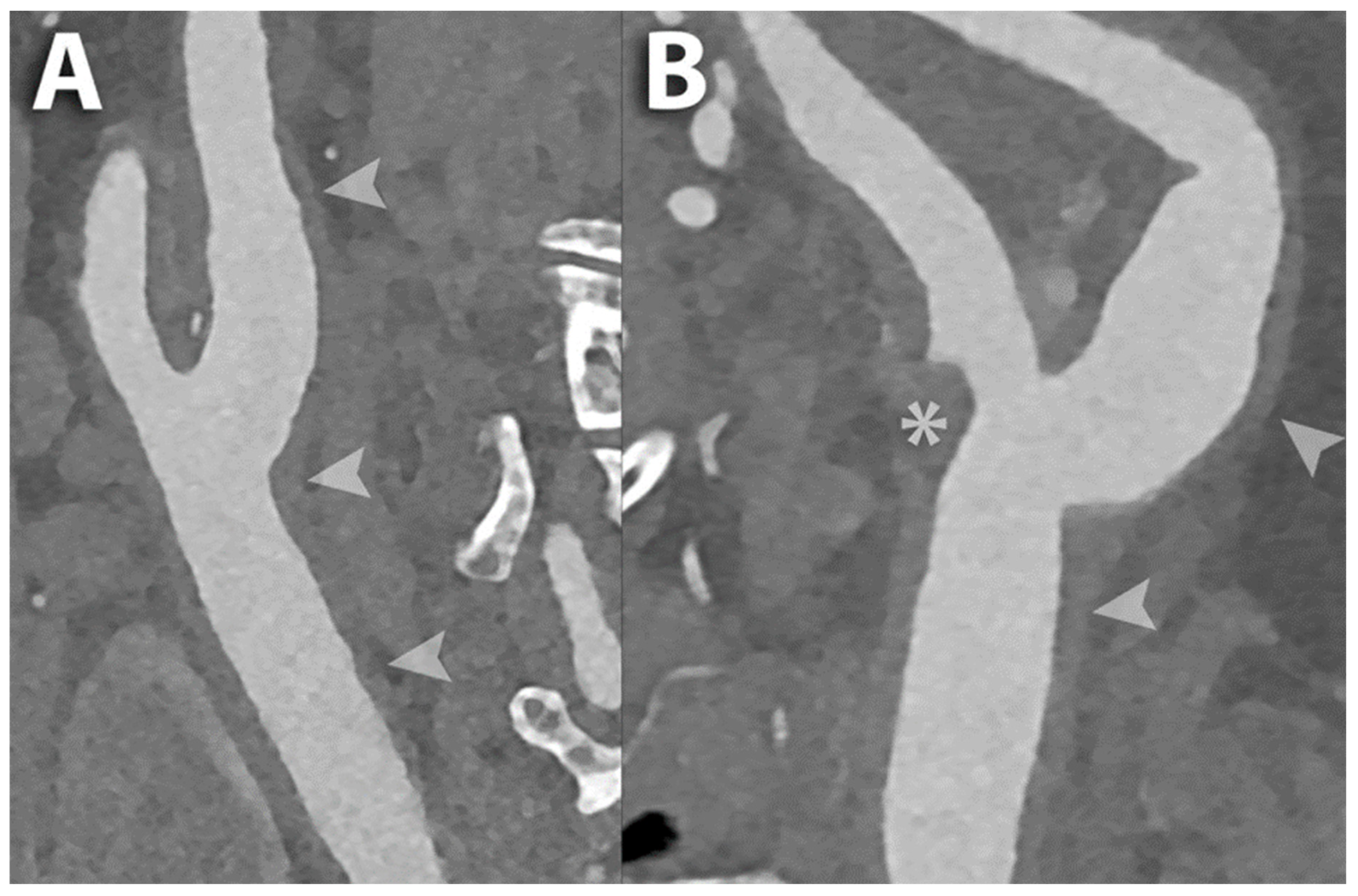 Diagnostics 14 02012 g002