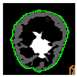 Diagnostics 14 02045 i014