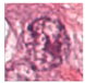 Diagnostics 14 02045 i017