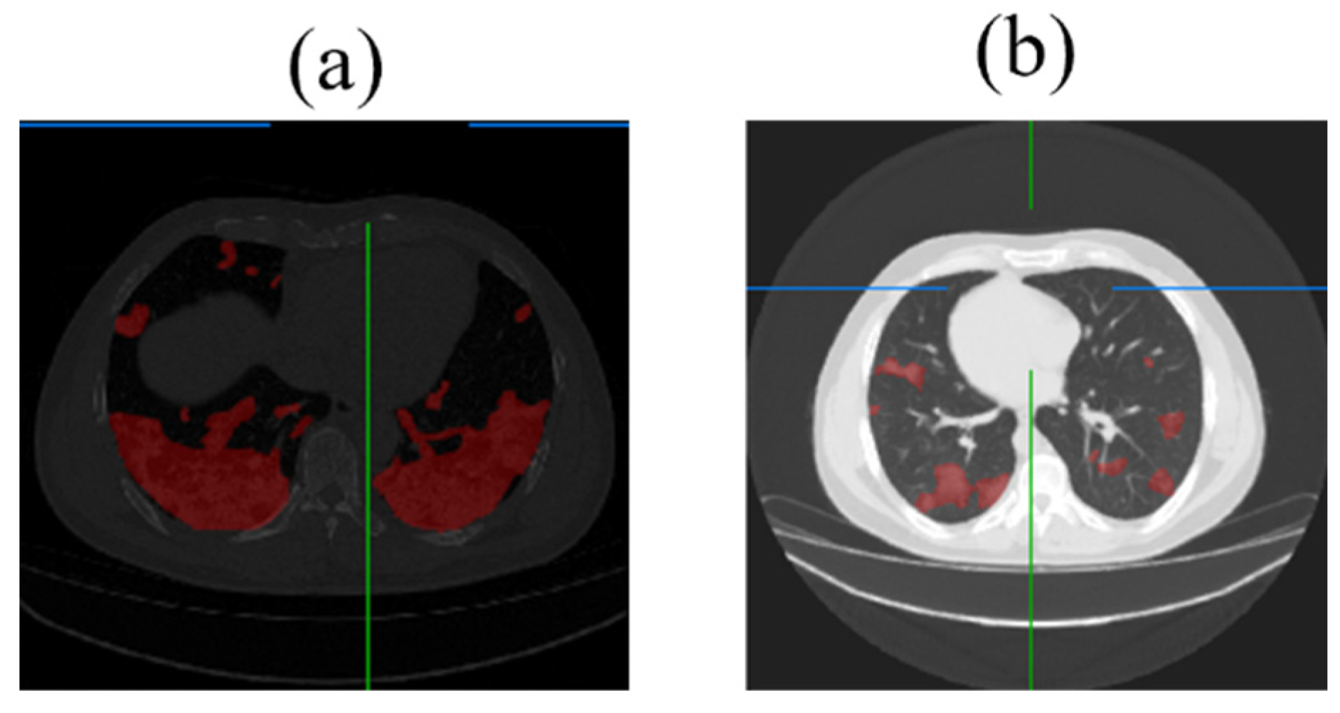 Diagnostics 14 02099 g016