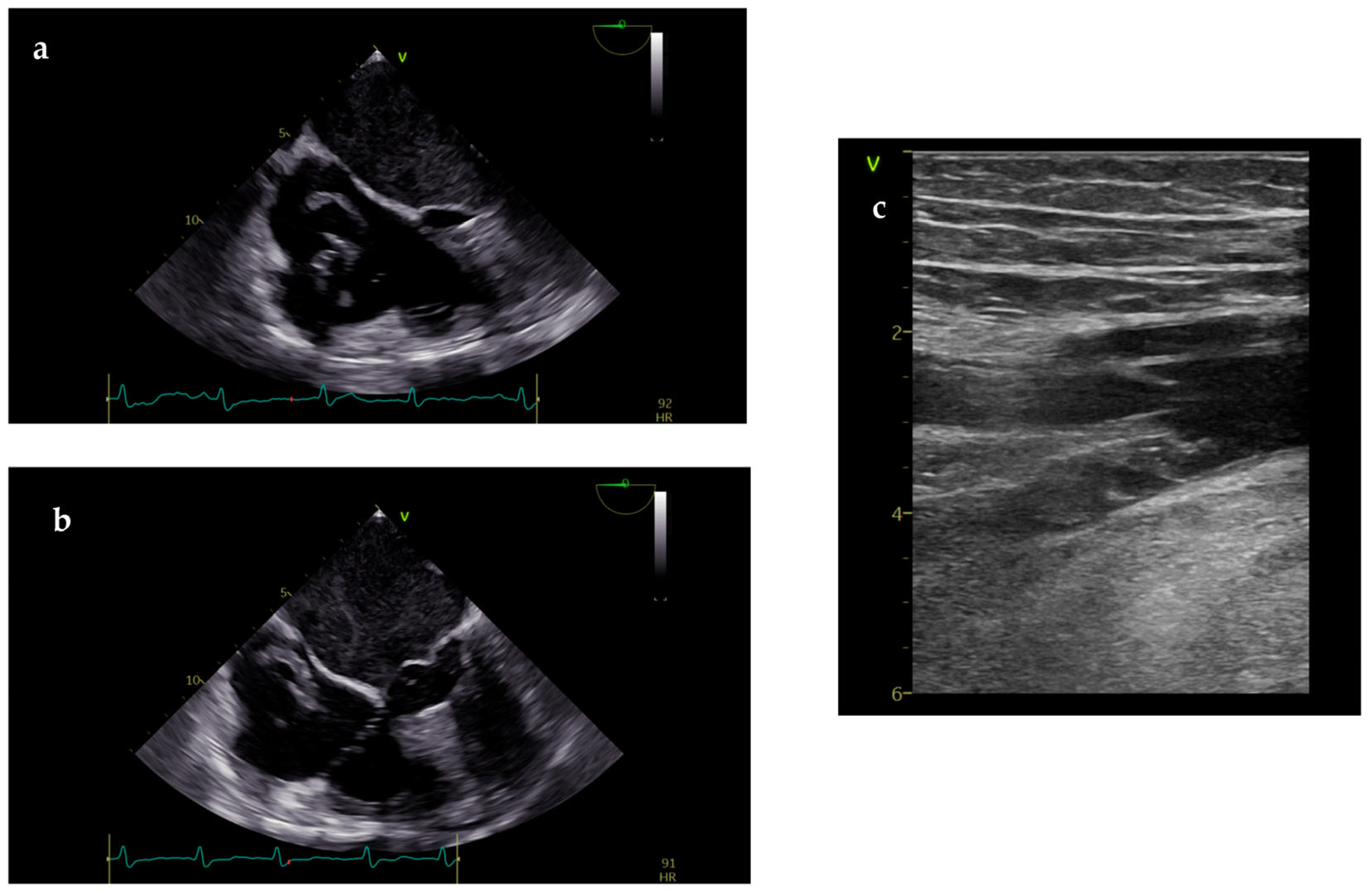 Diagnostics 14 02107 g002 Diagnostics 14 02107 g002