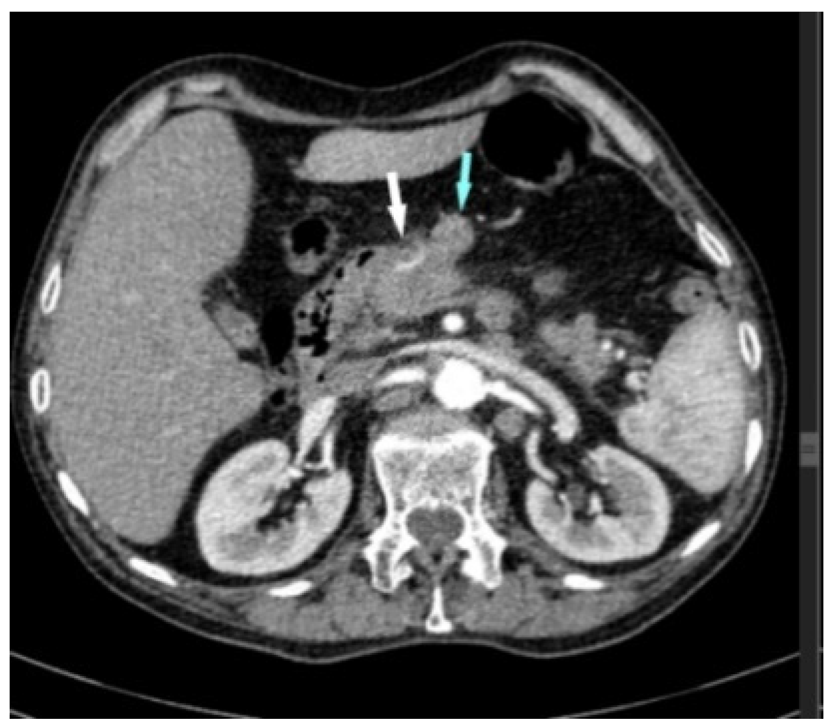 Diagnostics 14 02164 g001 Diagnostics 14 02164 g001