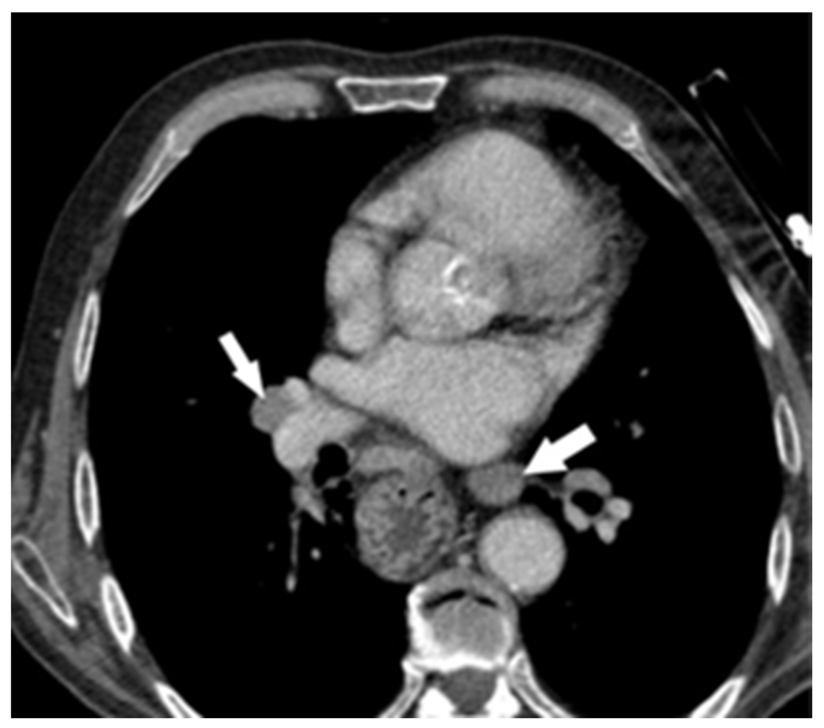 Diagnostics 14 02164 g003 Diagnostics 14 02164 g003