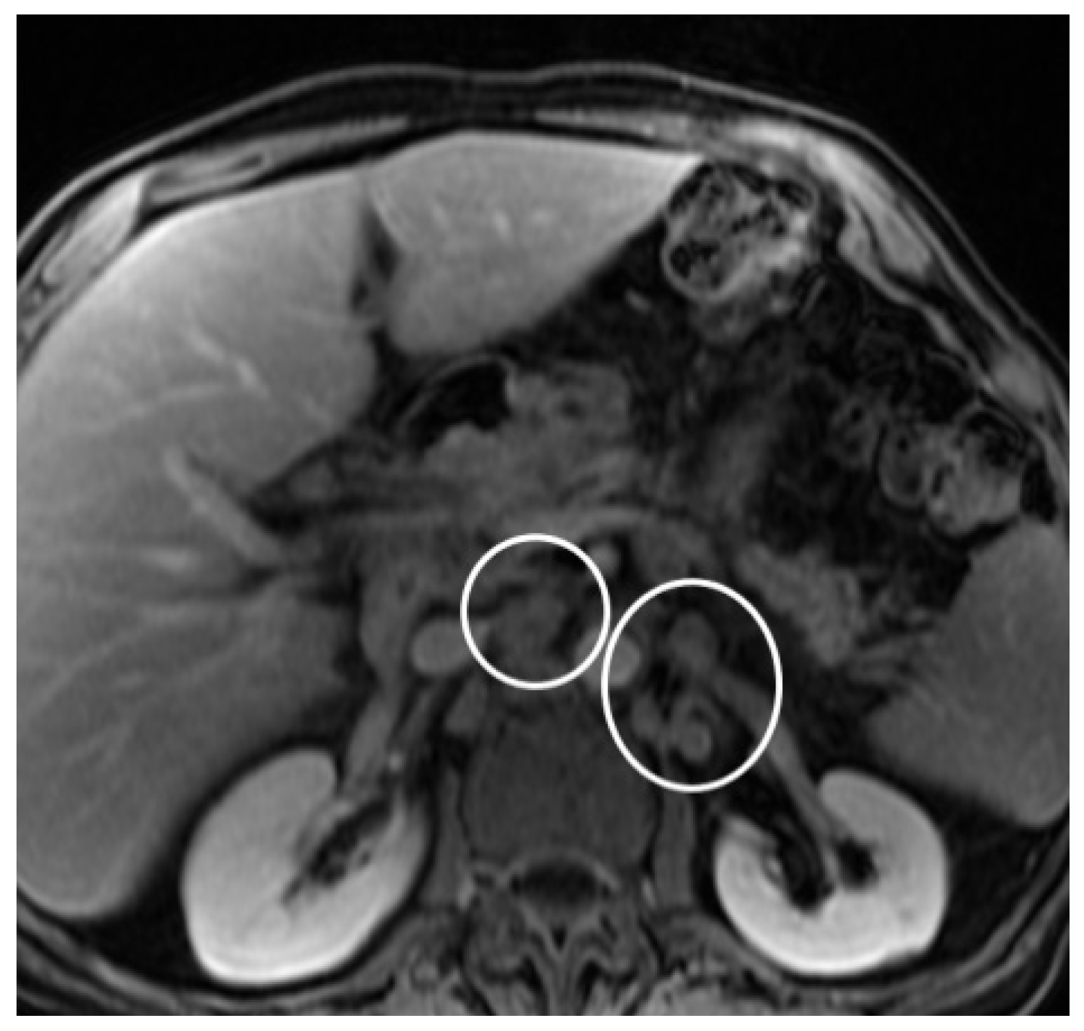 Diagnostics 14 02164 g006 Diagnostics 14 02164 g006