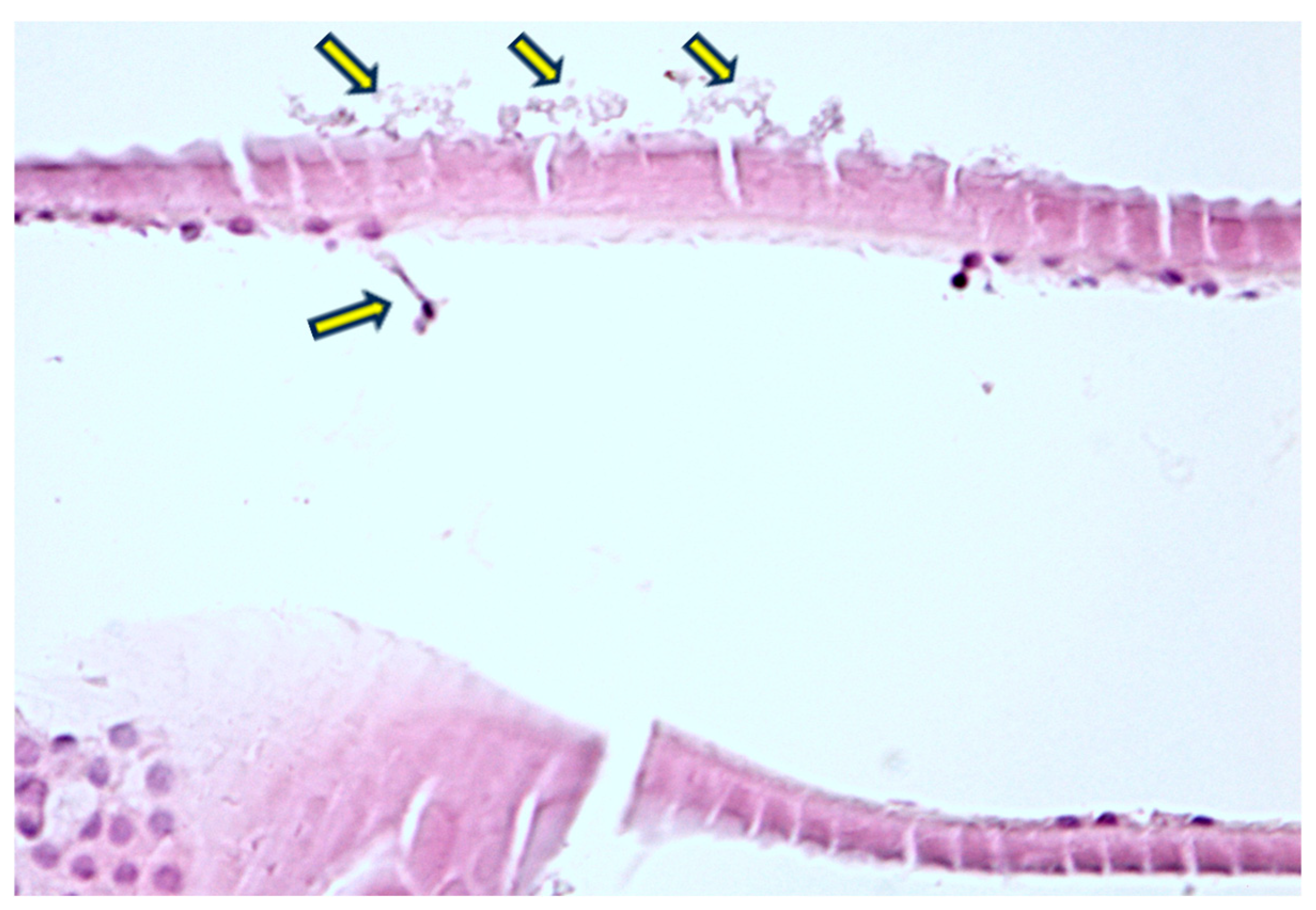 Diagnostics 14 02187 g004 Diagnostics 14 02187 g004