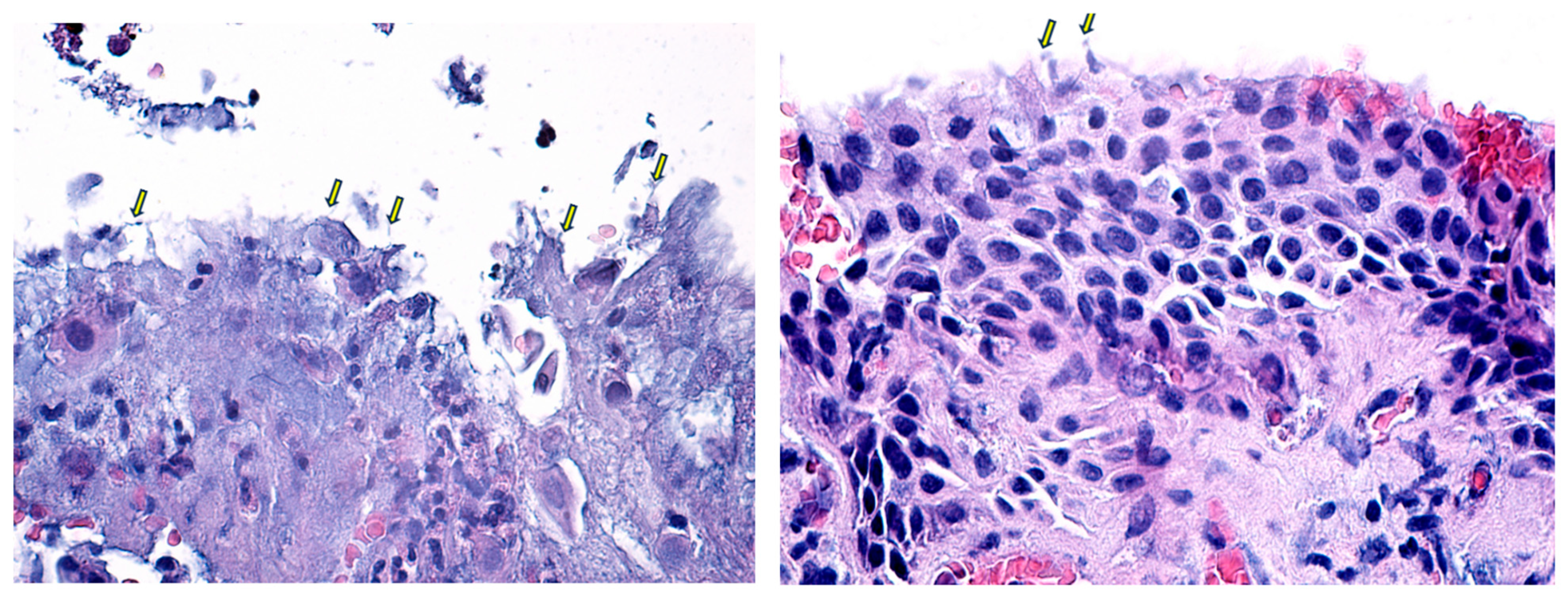 Diagnostics 14 02187 g006 Diagnostics 14 02187 g006