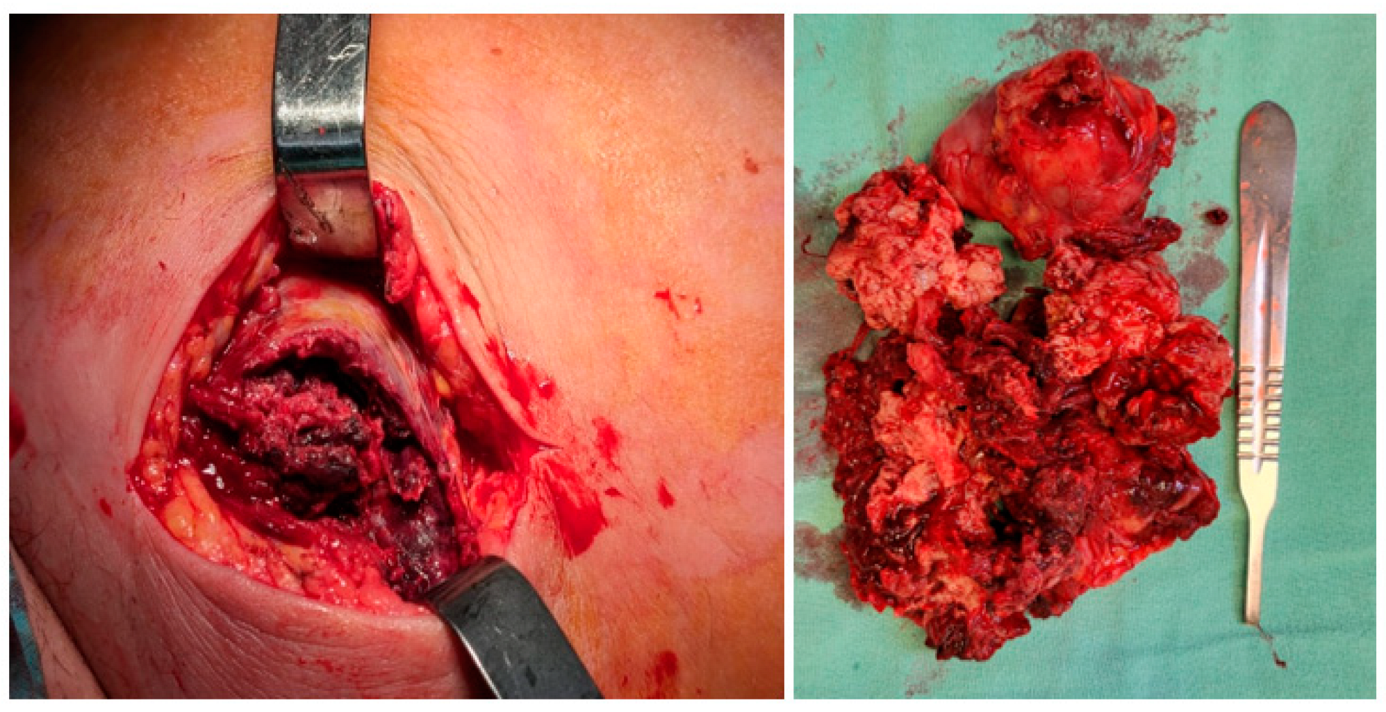 Diagnostics 14 02210 g003