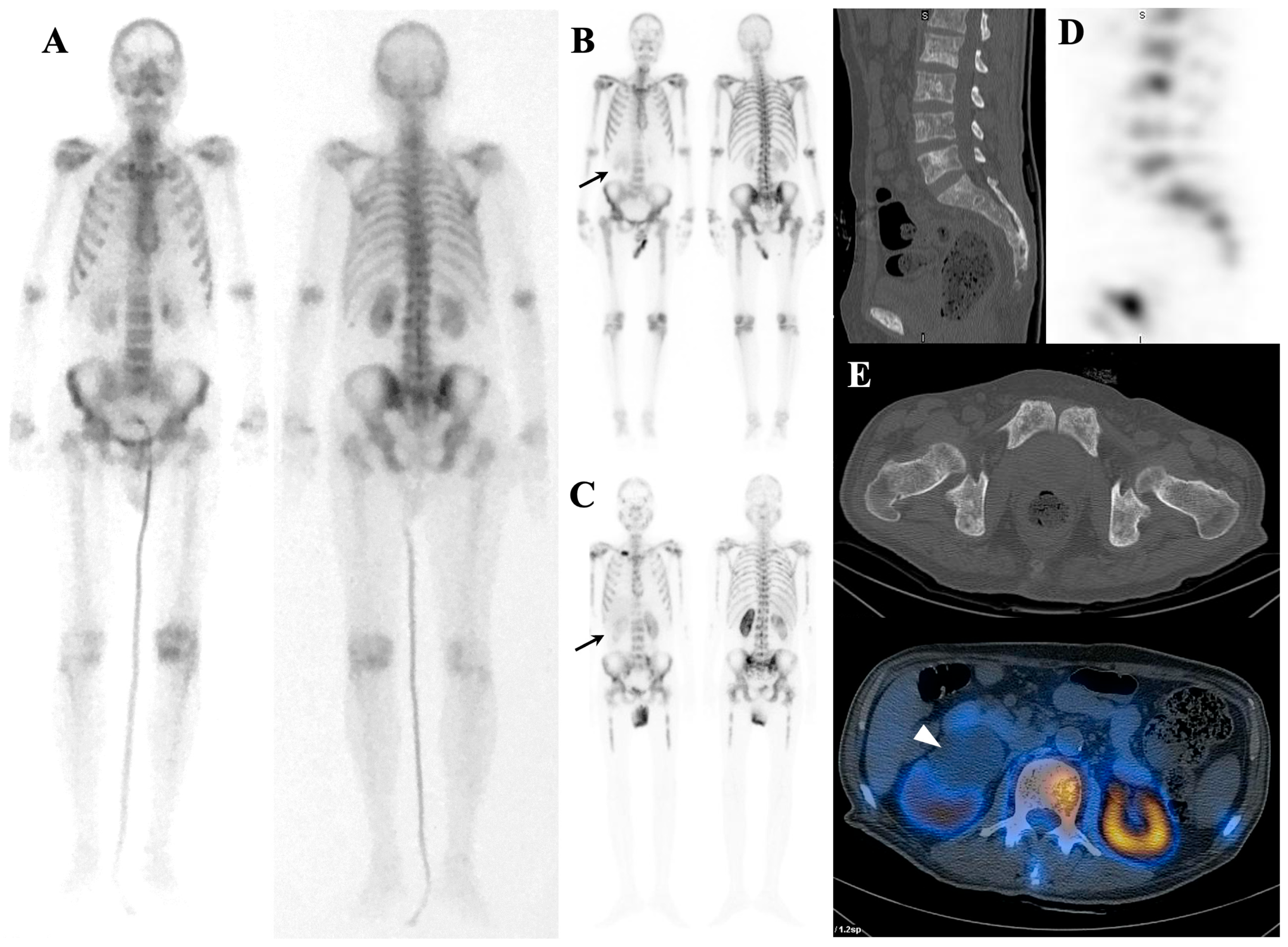 Diagnostics 14 02229 g003 Diagnostics 14 02229 g003