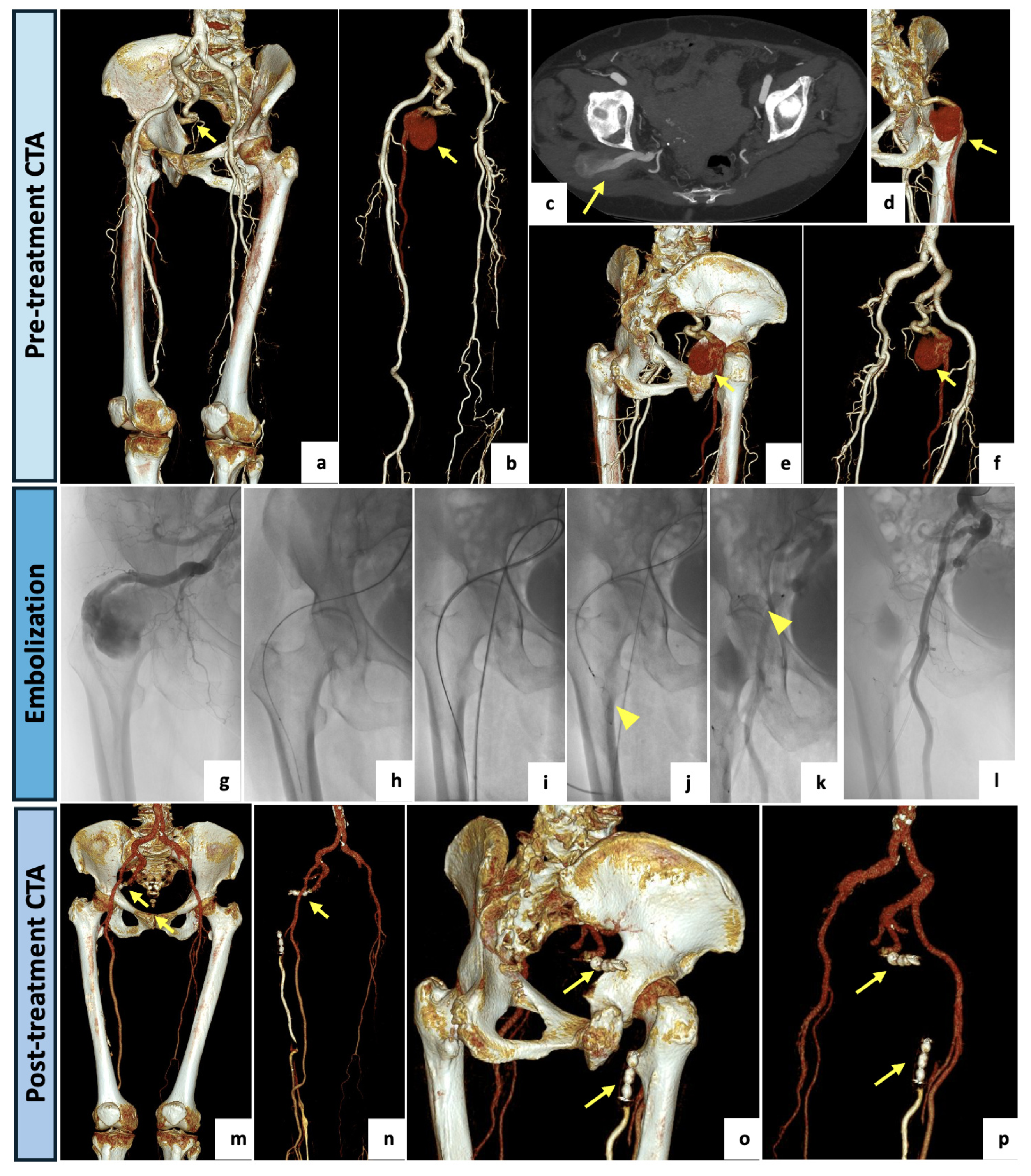 Diagnostics 14 02383 g002 Diagnostics 14 02383 g002