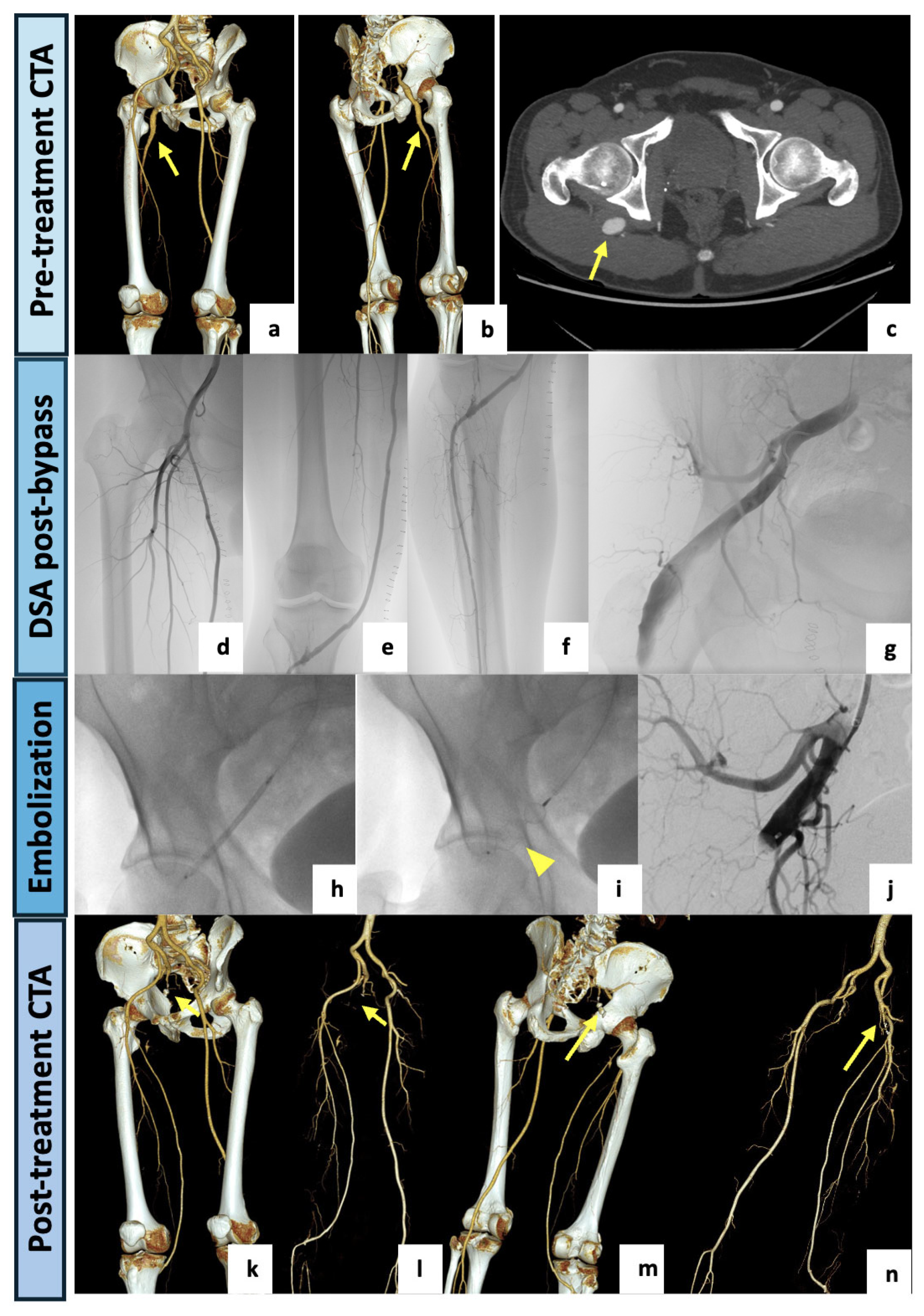 Diagnostics 14 02383 g003 Diagnostics 14 02383 g003