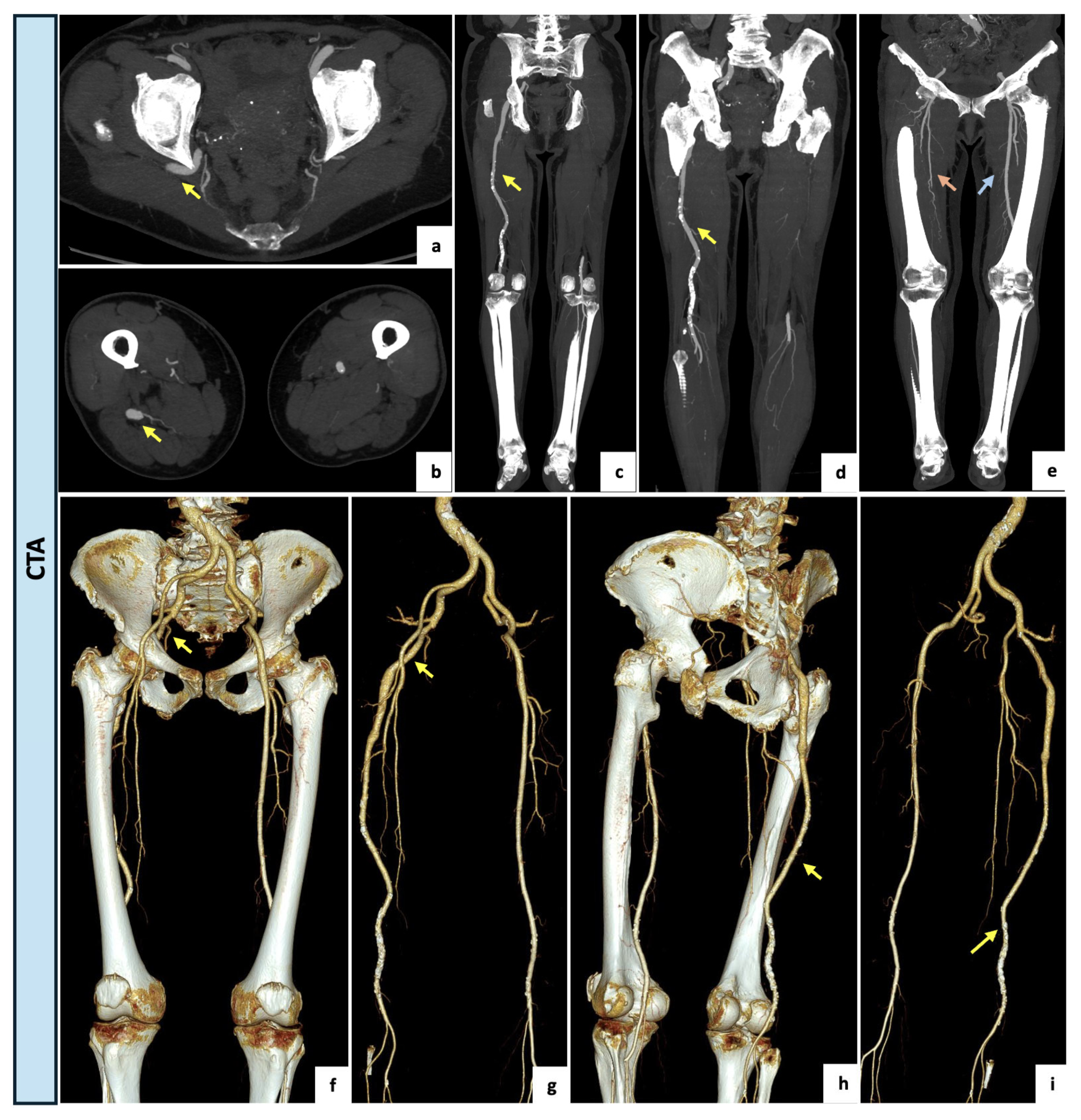 Diagnostics 14 02383 g004 Diagnostics 14 02383 g004
