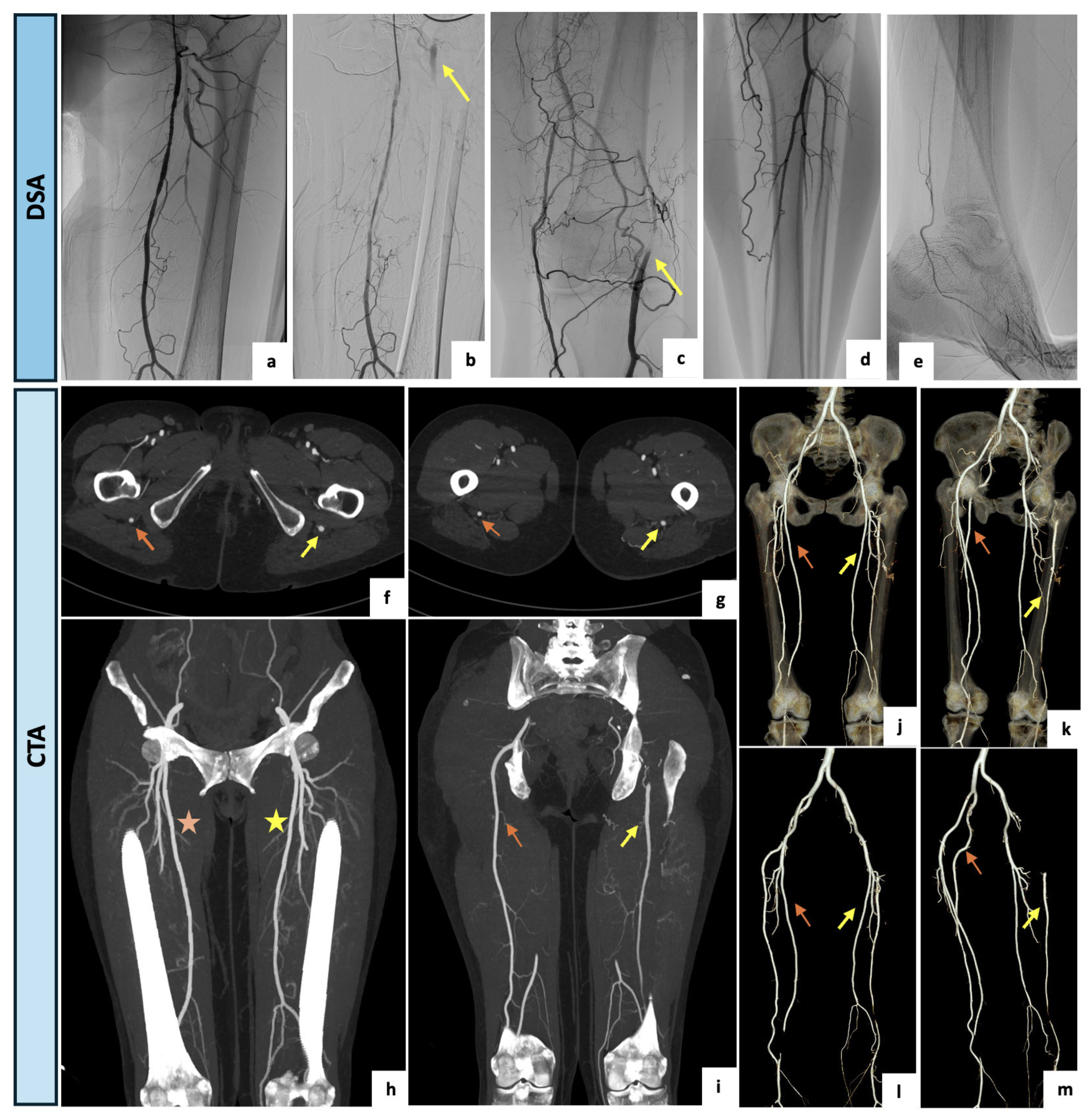 Diagnostics 14 02383 g005 Diagnostics 14 02383 g005