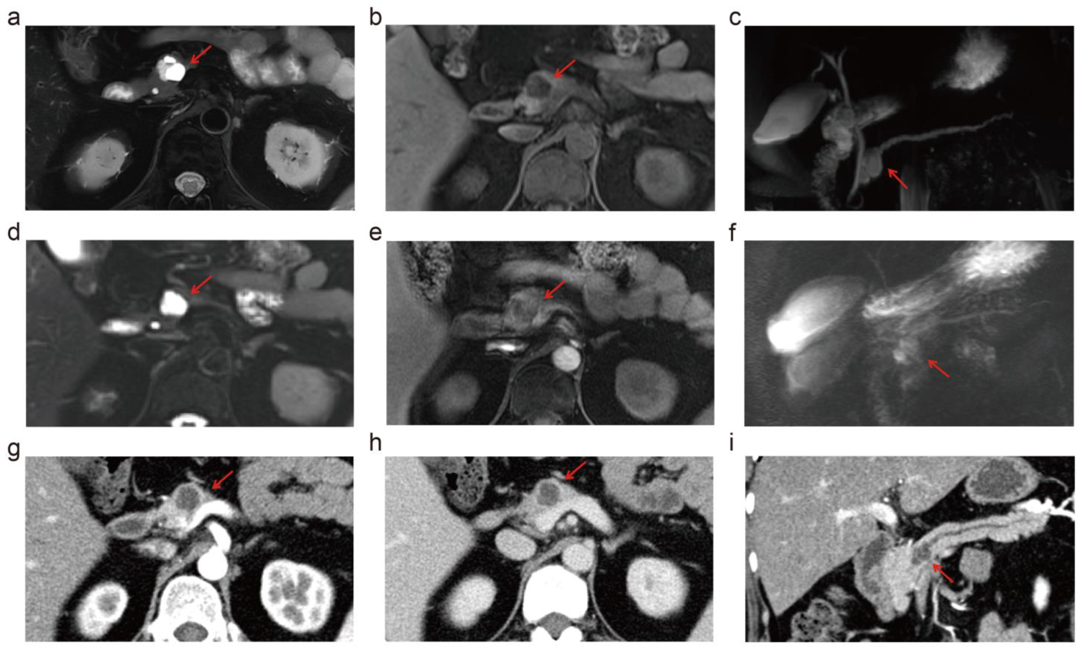 Diagnostics 14 02457 g005 Diagnostics 14 02457 g005