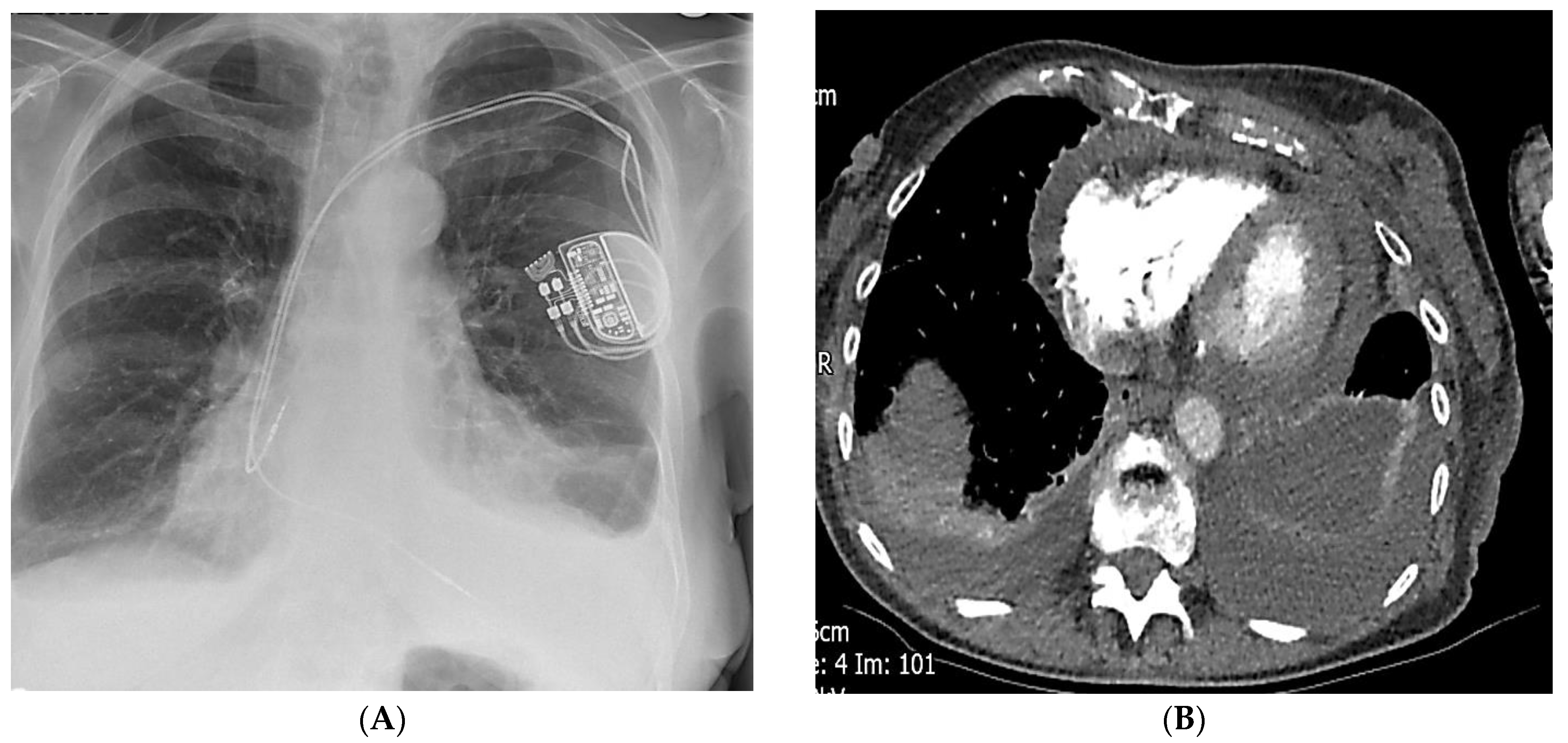 Diagnostics 14 02465 g004a