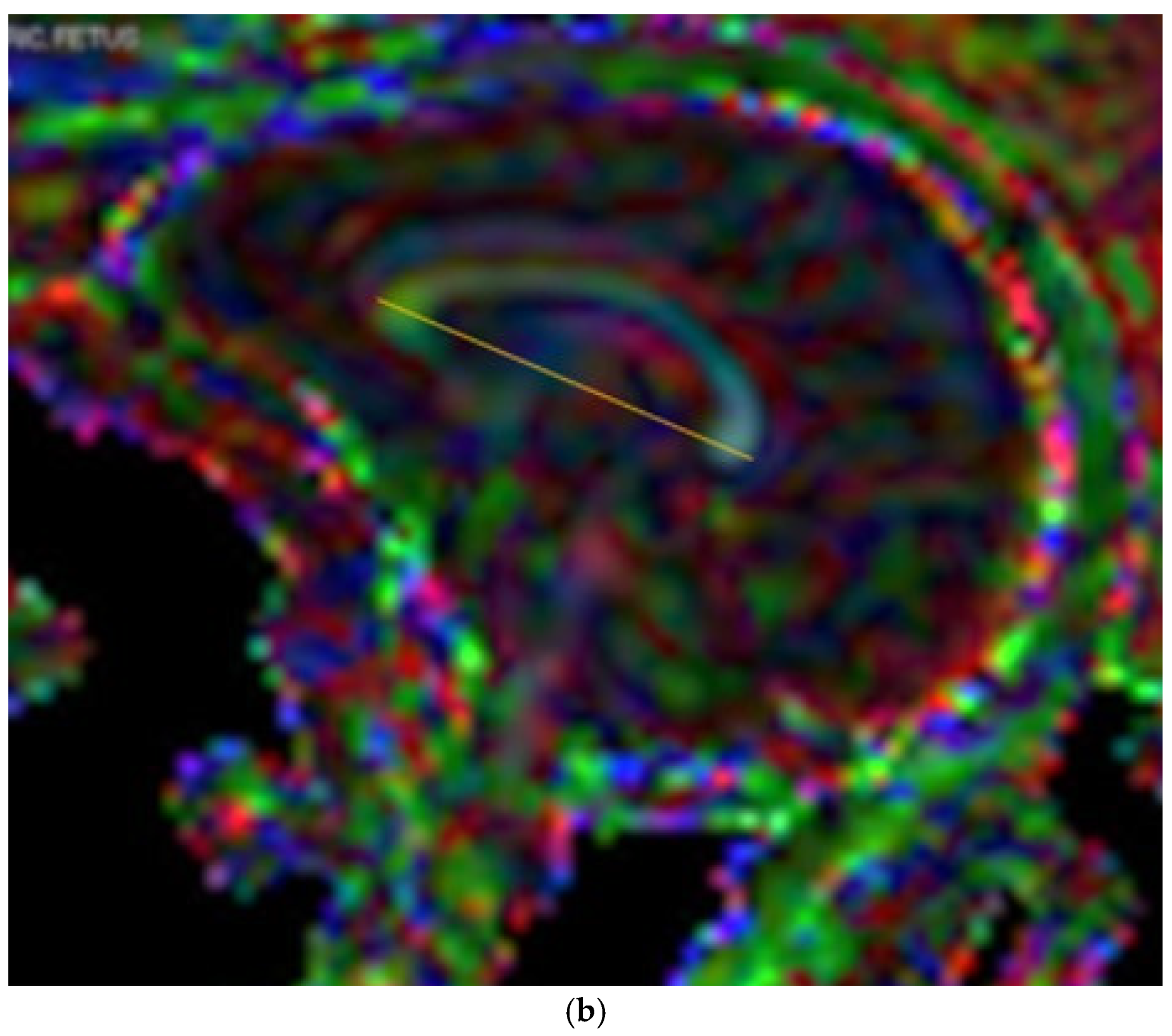 Diagnostics 14 02700 g001b