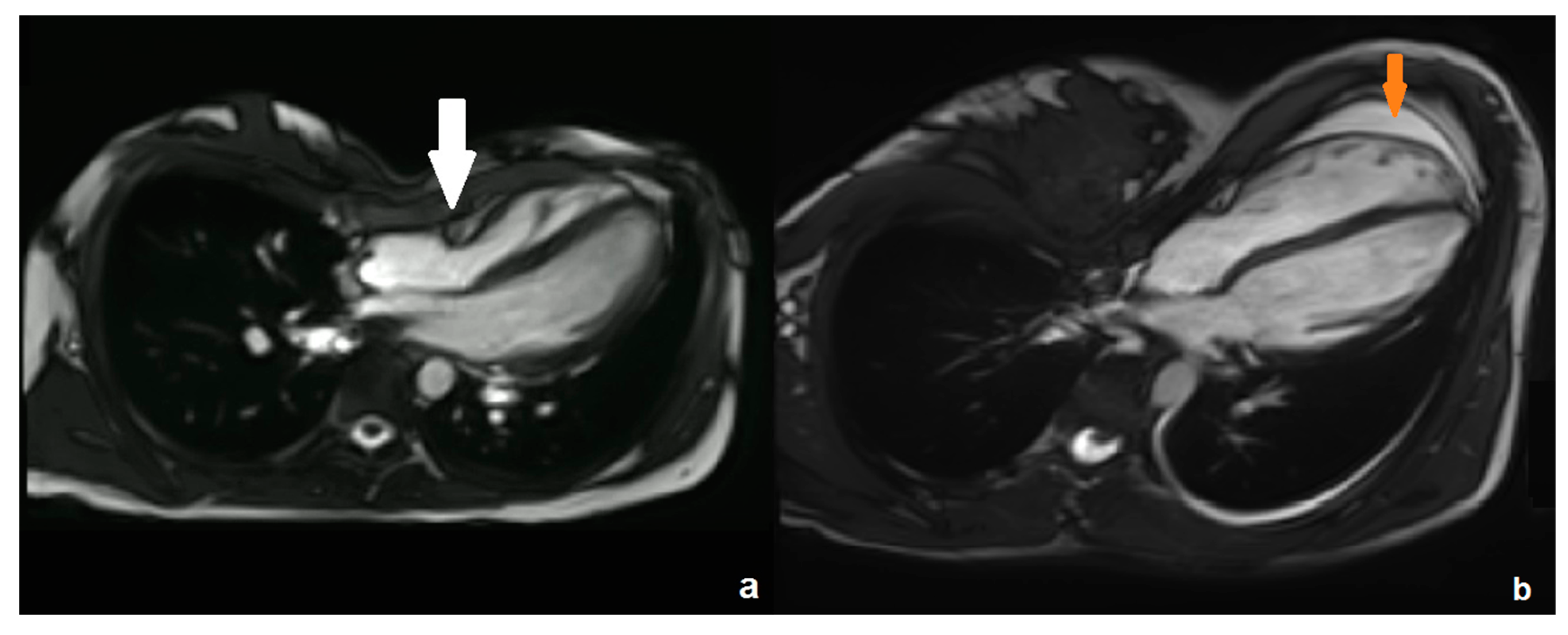 Diagnostics 14 02758 g001