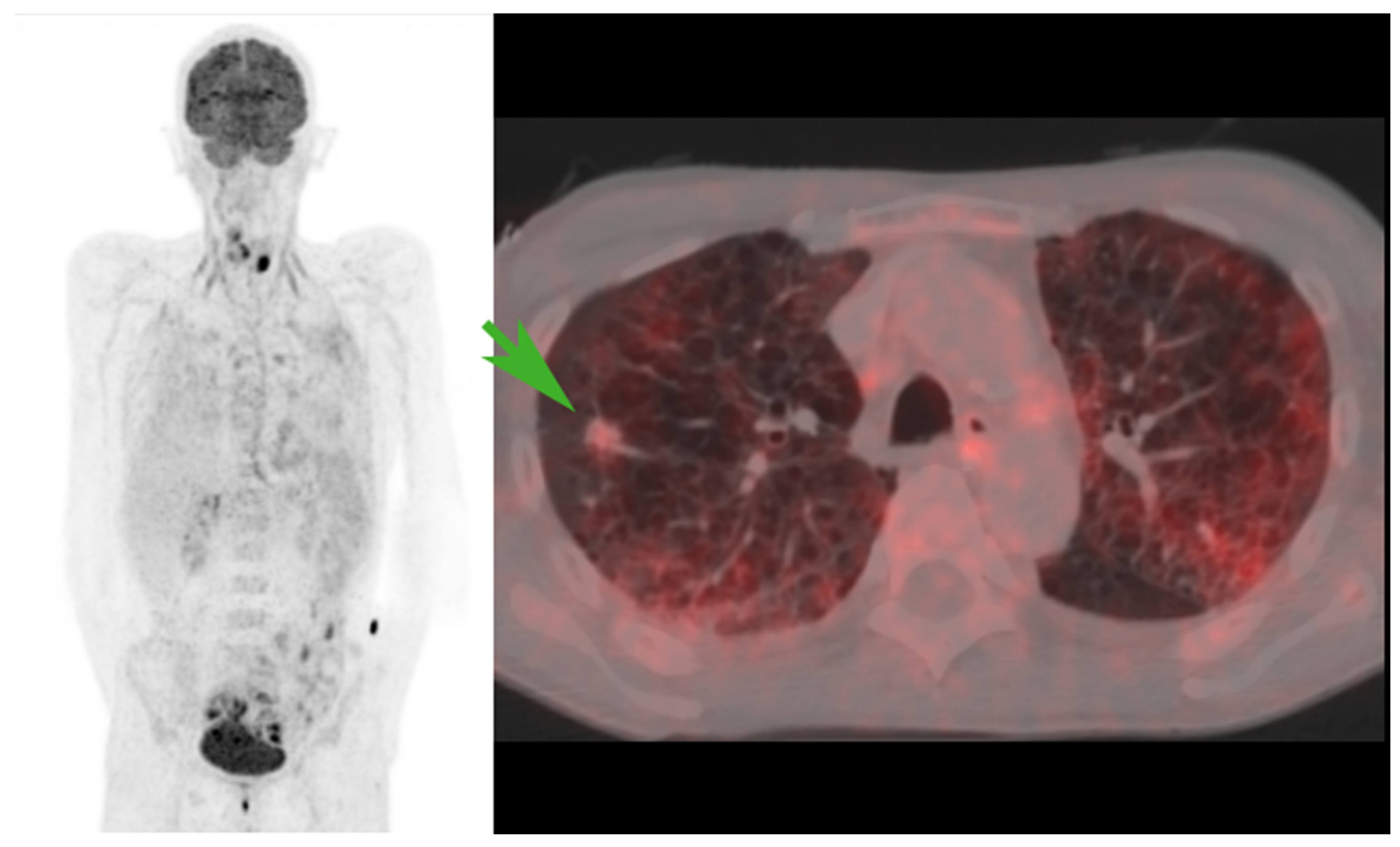 Diagnostics 14 02764 g003 Diagnostics 14 02764 g003