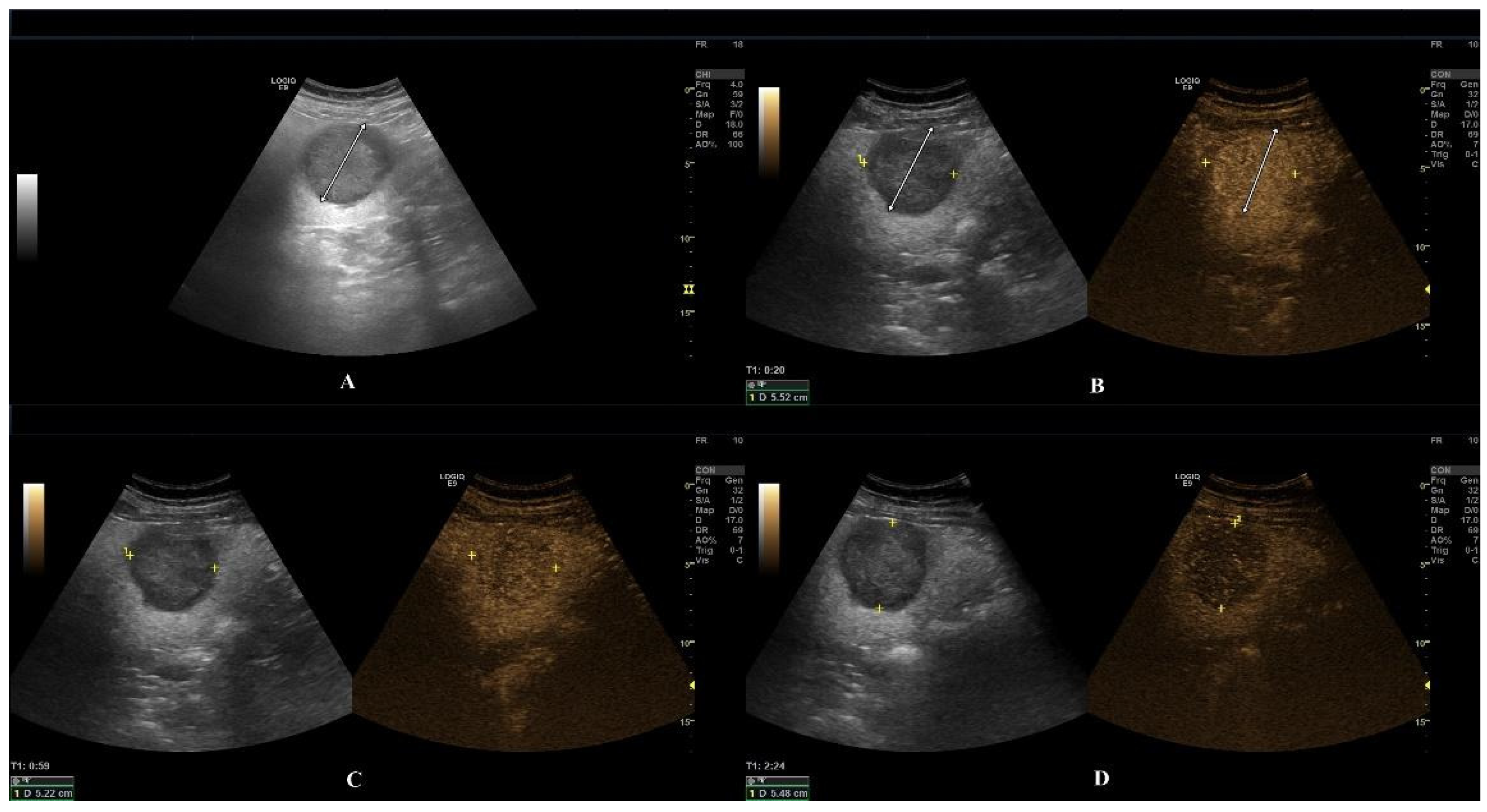 Diagnostics 15 00046 g004