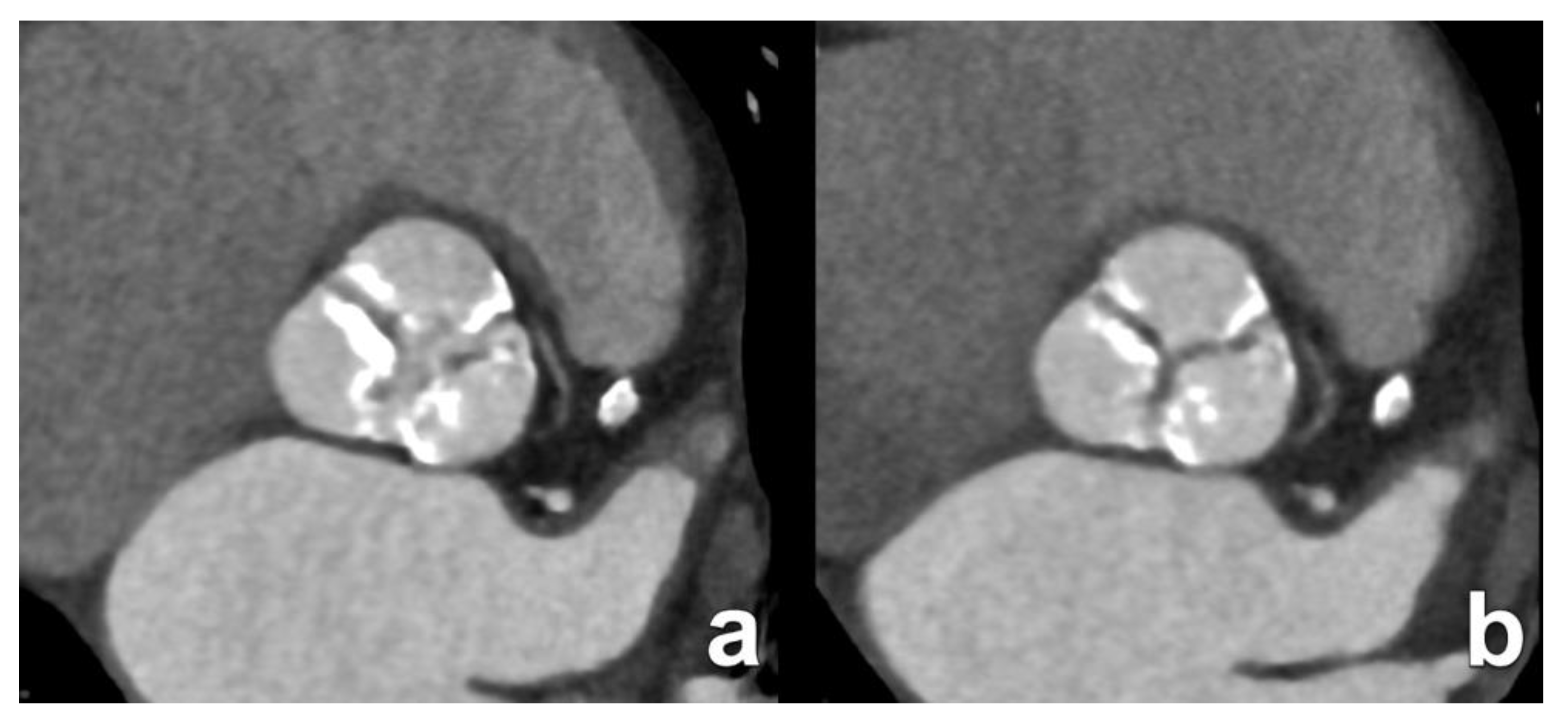 Diagnostics 15 00097 g003 Diagnostics 15 00097 g003