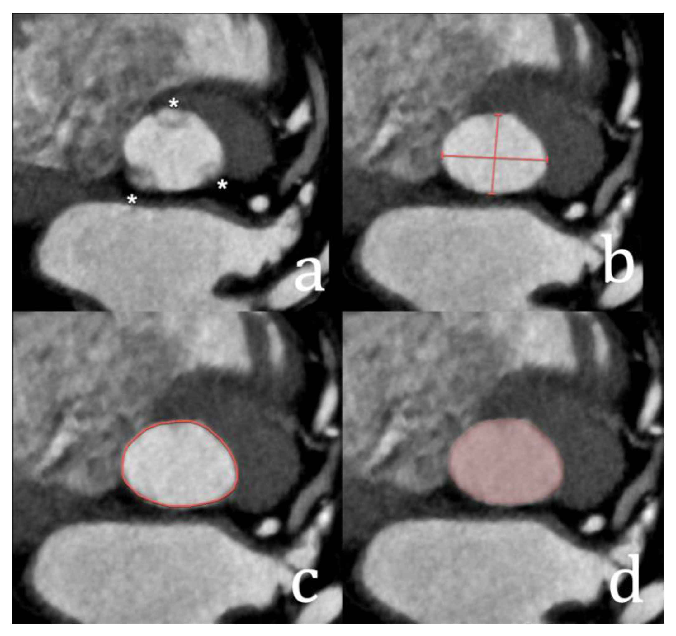 Diagnostics 15 00097 g005 Diagnostics 15 00097 g005